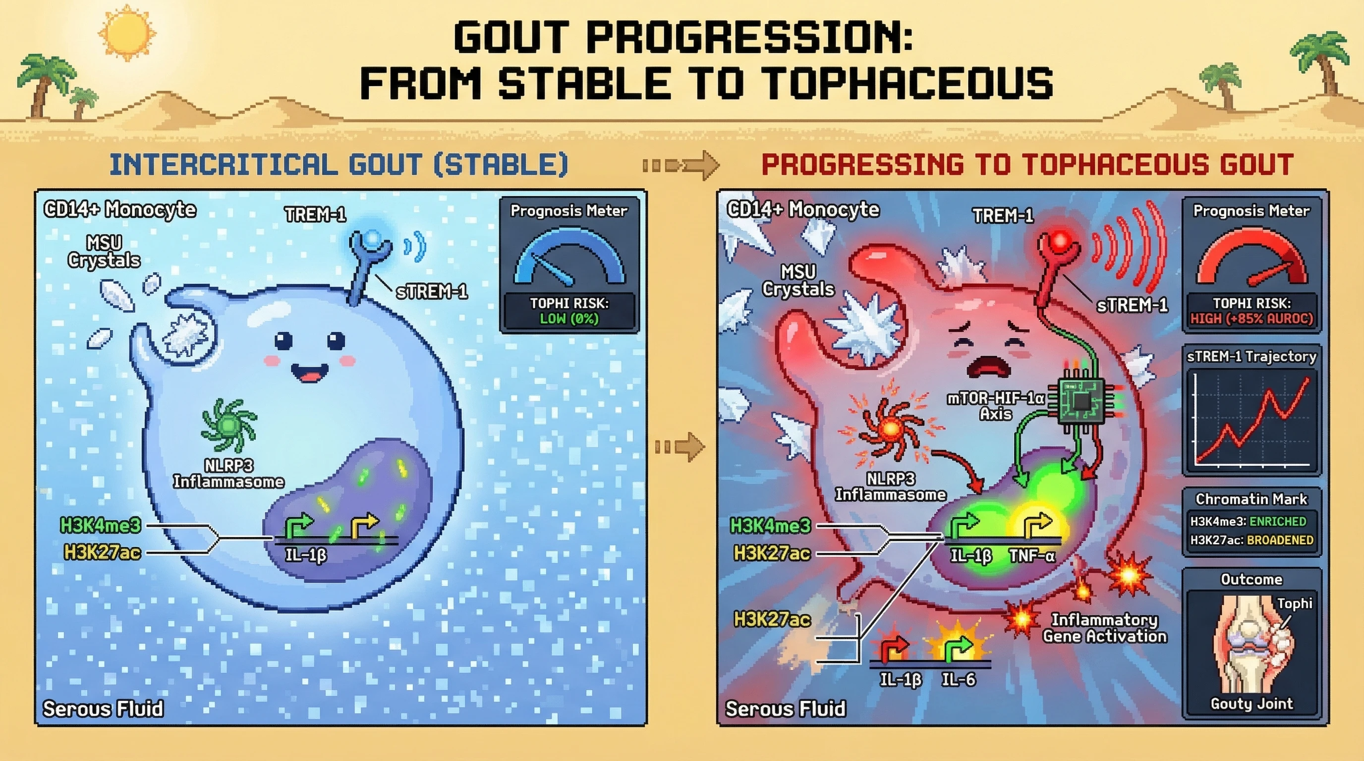 Infographic for: Serum Soluble TREM-1 Kinetics Combined With Monosodium Urate Crystal-Induced Trained Immunity Epigenomic Signatures in Circulating Monocytes Predict Transition From Intercritical Gout to Chronic Tophaceous Disease 12–24 Months Before Clinical Detection
