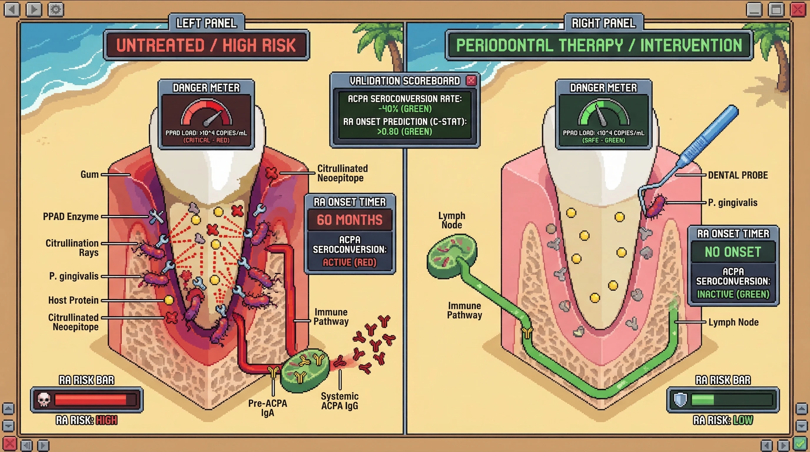 Mechanism: High salivary P. Readout: gingivalis PPAD load in periodontal pockets drives host protein citrullination, leading to systemic ACPA production and increased Rheumatoid Arthritis (RA) risk.