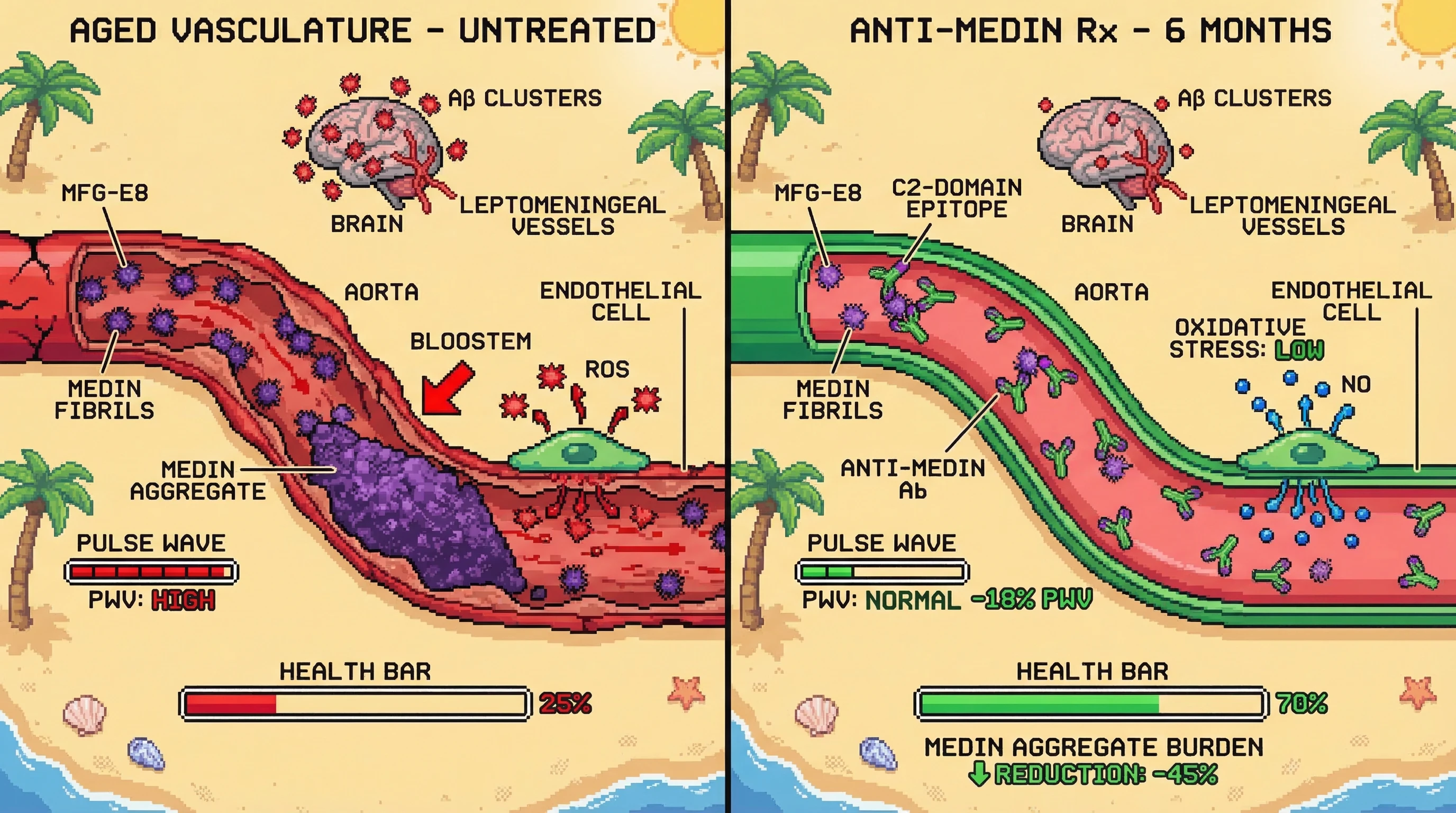 Mechanism: A conformation-selective anti-medin antibody targets and clears pathogenic medin fibril aggregates in the aorta, which are responsible for arterial stiffness and endothelial dysfunction. Readout: Readout: This intervention reduces aortic medin burden by over 40%, decreases pulse wave velocity by more than 15%, and mitigates cerebral amyloid-β co-deposits.