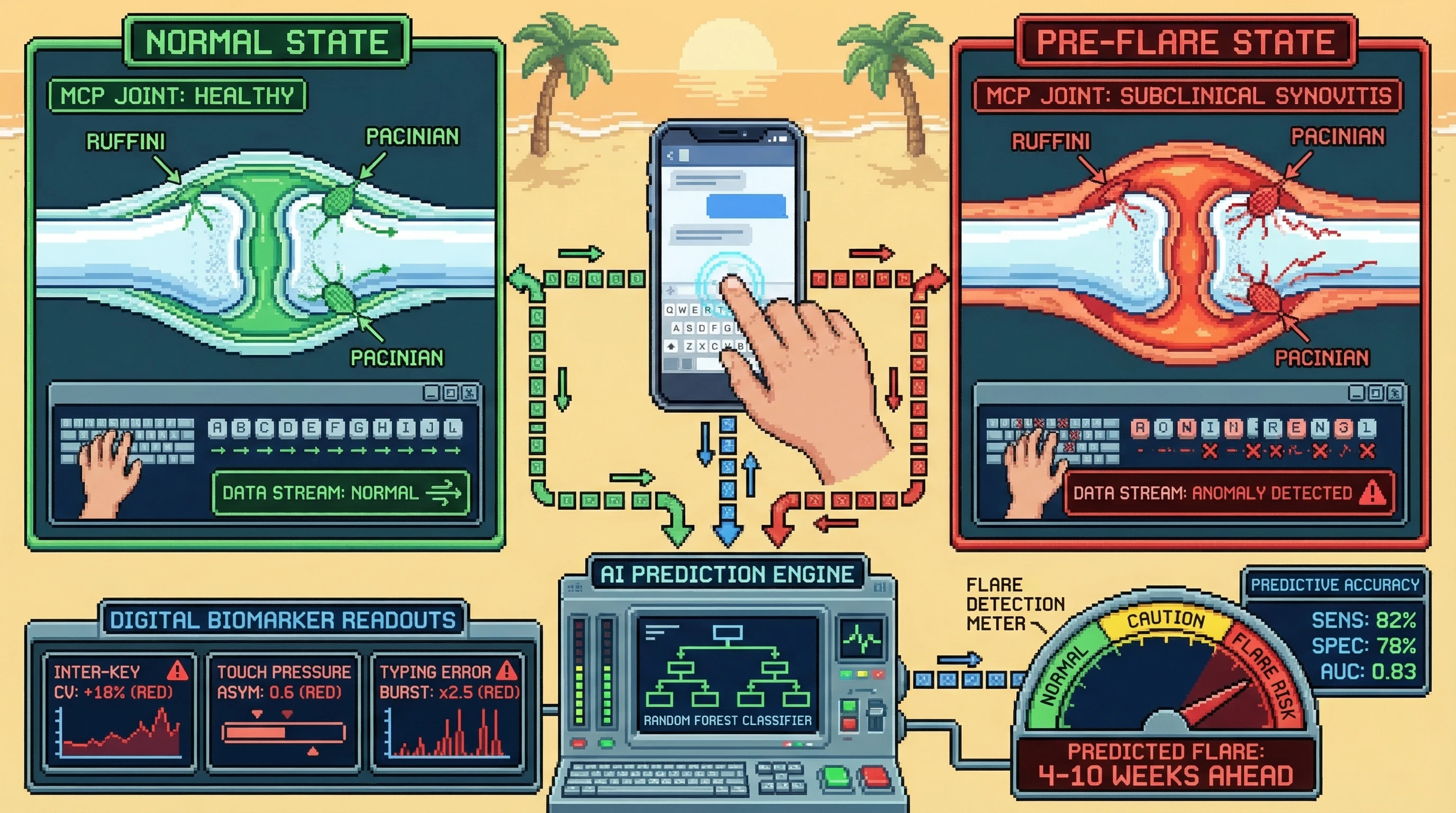Infographic for: Smartphone Keystroke Dynamics and Touch Pressure Variability as Digital Biomarkers for Subclinical Hand Joint Inflammation in Rheumatoid Arthritis 4–10 Weeks Before Clinical Flare Detection