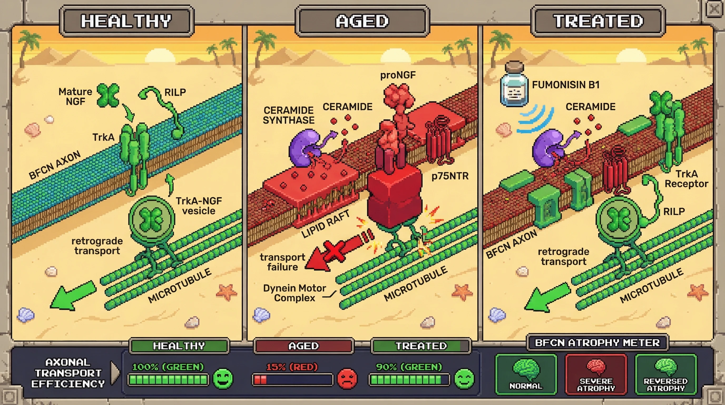 Infographic for: The Axonal Dynein-Lipid Partitioning Hypothesis: ProNGF-Induced p75NTR/TrkA Dimerization as a Spatial Gatekeeper of Retrograde Transport