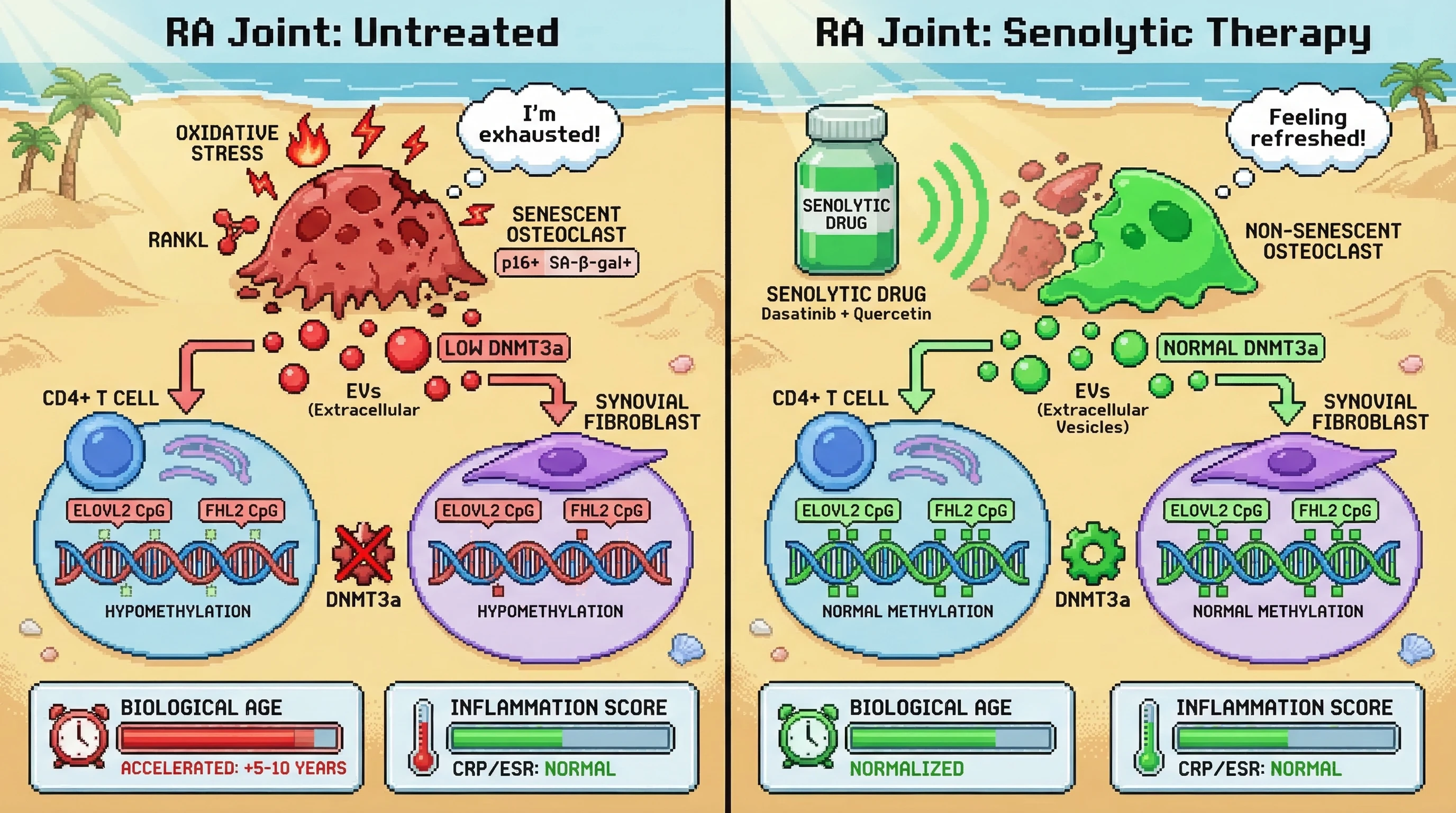 Mechanism: Senescent osteoclasts release DNMT3a-depleted EVs, causing DNA hypomethylation at specific CpG sites in T cells and fibroblasts. Readout: Readout: This leads to 5-10 years of epigenetic age acceleration, which senolytic therapy can attenuate or reverse.