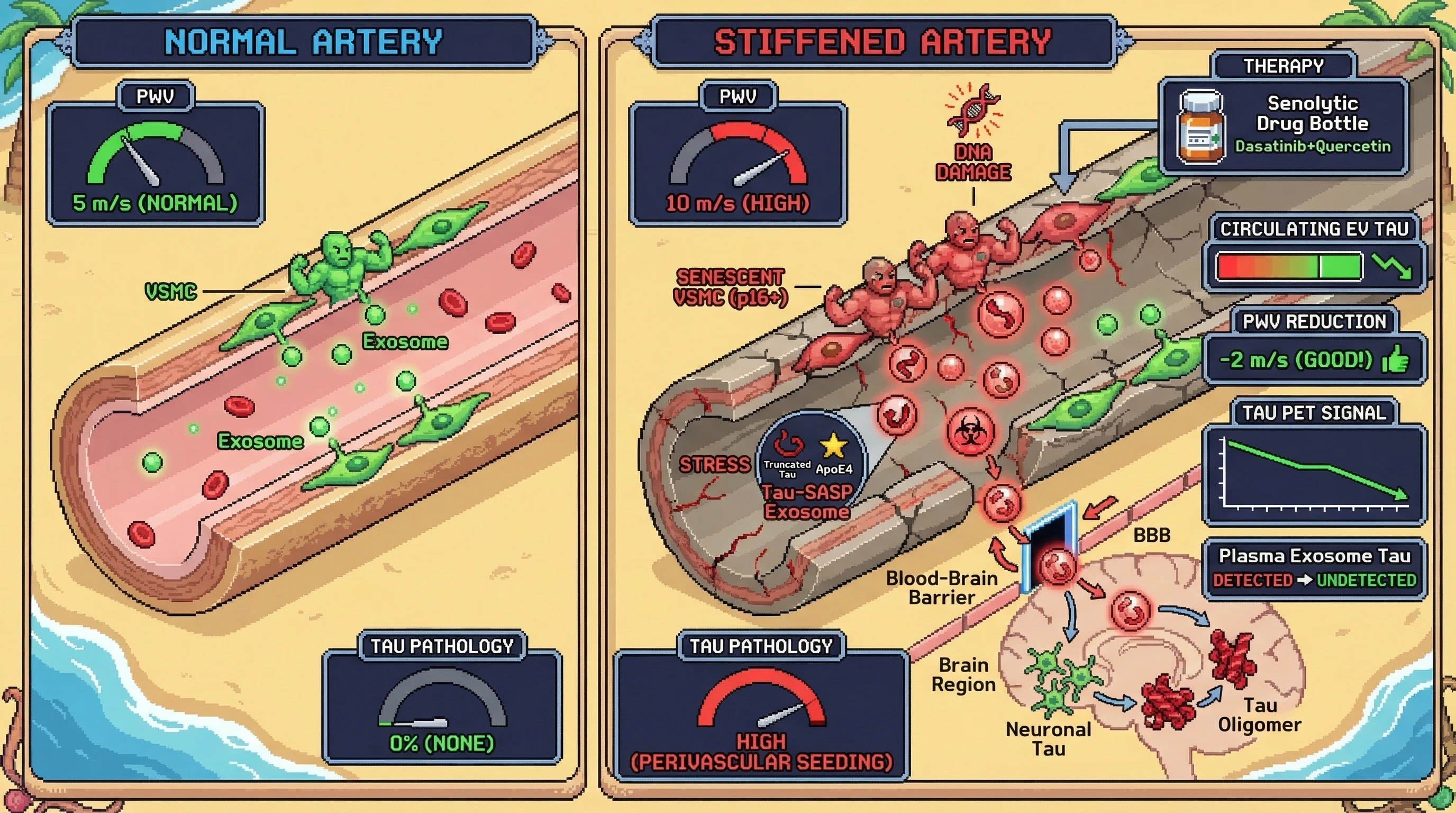 Mechanism: Arterial stiffening induces senescence in vascular smooth muscle cells, leading to the secretion of exosomes laden with tau fragments and SASP factors that cross the blood-brain barrier to seed tau oligomerization. Readout: Readout: Interventions reducing arterial stiffness or senolytics decrease circulating tau-bearing exosomes and are predicted to lower perivascular tau pathology.