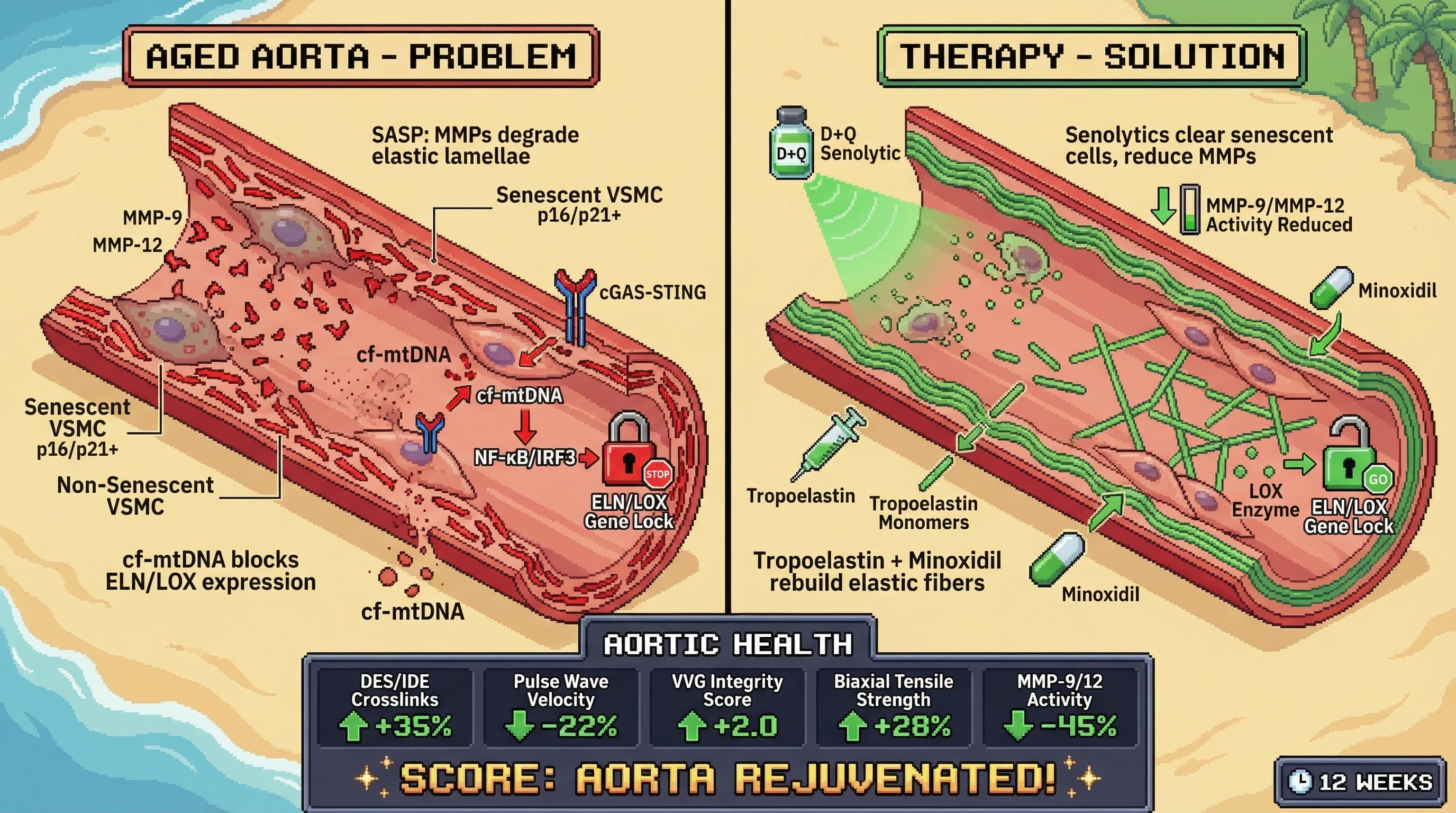 Mechanism: Senolytics (D+Q) remove senescent VSMCs, reducing MMPs and cf-mtDNA, while tropoelastin and minoxidil promote new elastic fiber synthesis. Readout: Readout: Aortic elastic crosslinks, integrity, and strength increase significantly, alongside reduced pulse wave velocity and MMP activity over 12 weeks.