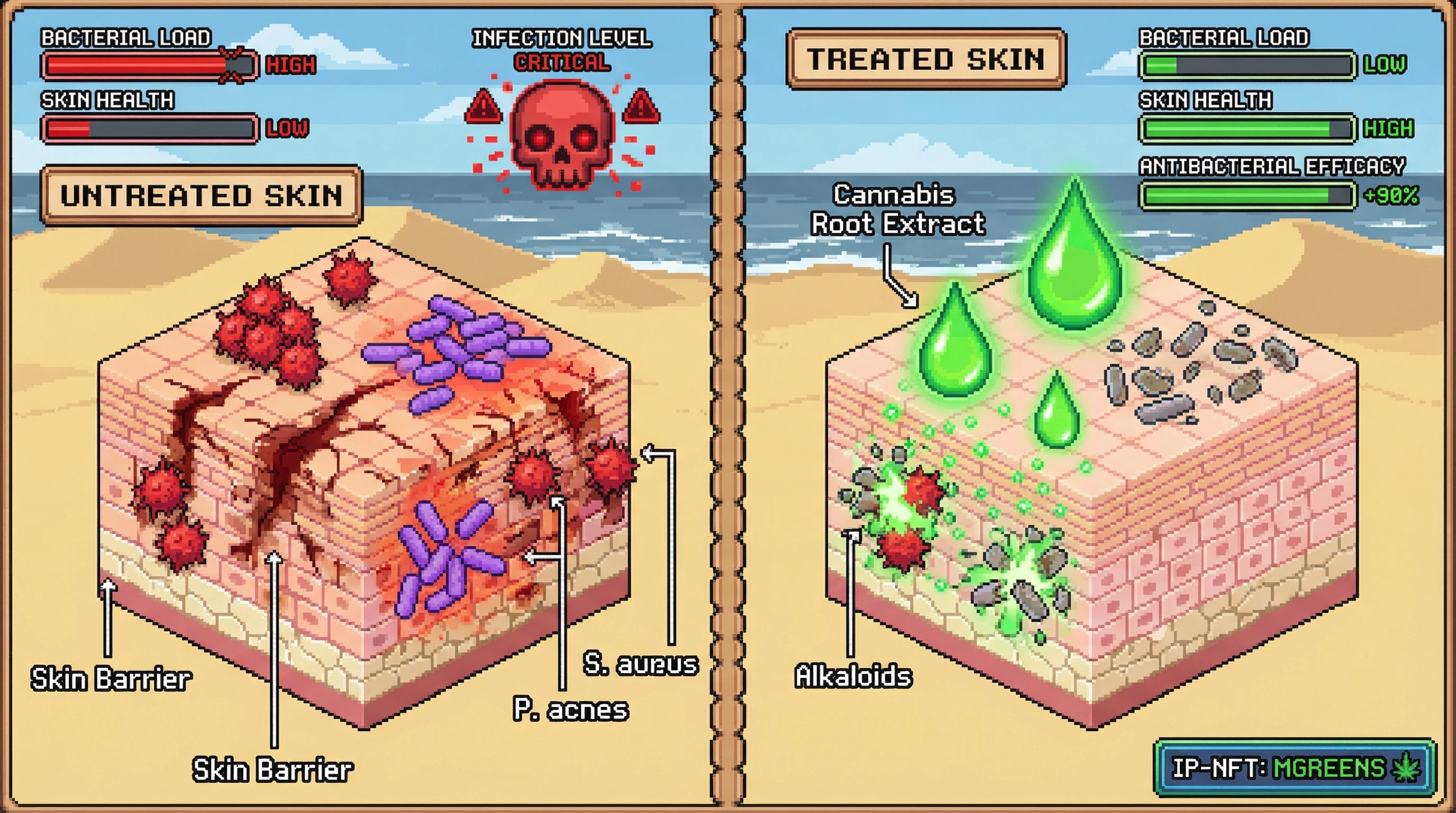 This infographic illustrates how cannabis root extracts, particularly their alkaloid compounds, combat bacterial skin infections by reducing pathogen load and promoting skin health, acting as a natural alternative to conventional treatments.
