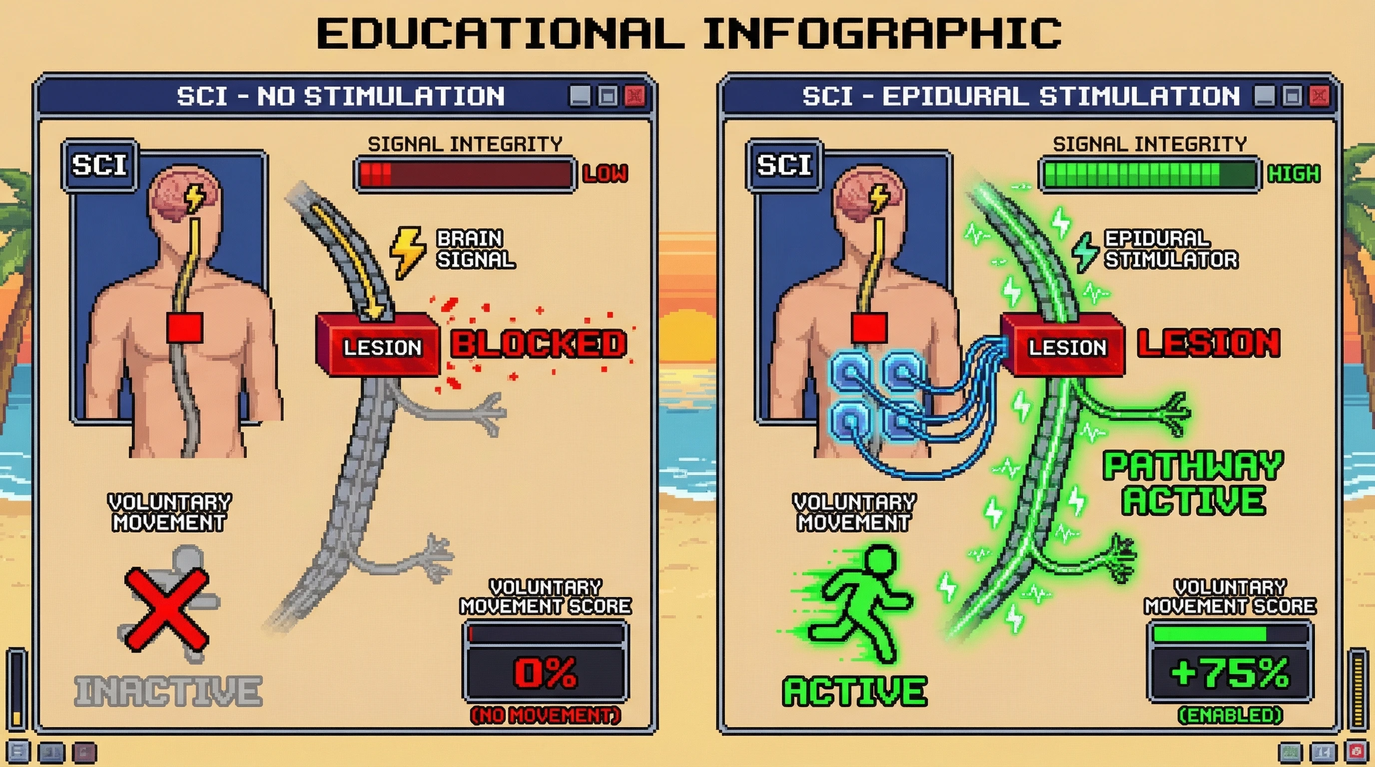 Infographic for: Epidural Stimulation Enables Voluntary Movement After Complete SCI—But the Mechanism Is Not What We Thought