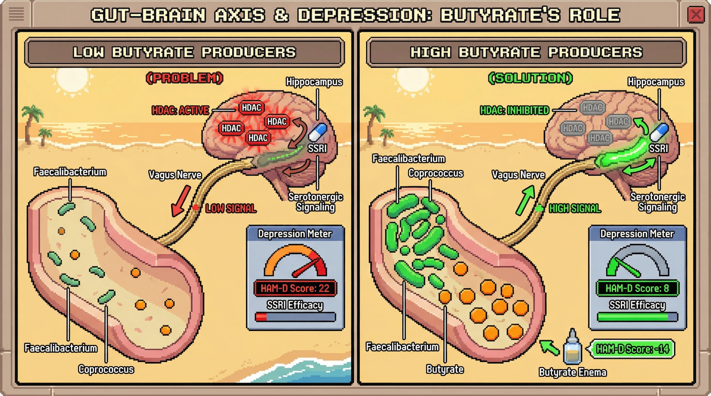 Infographic for: Baseline fecal butyrate-producer abundance predicts SSRI efficacy through vagal-dependent histone deacetylase inhibition