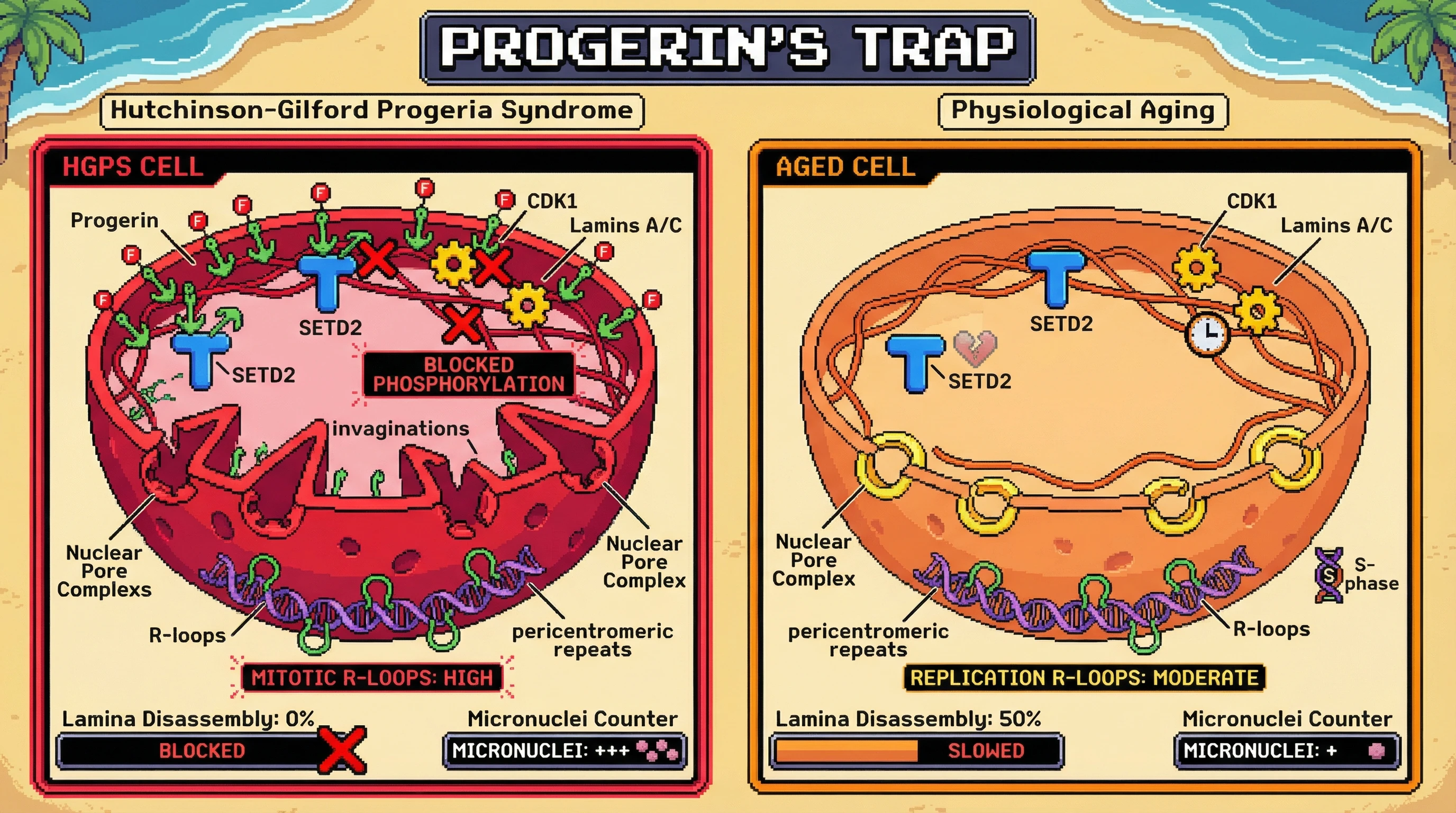 Infographic for: Progerin sequesters SETD2 at the envelope, blocking lamina disassembly and driving HGPS R-loops