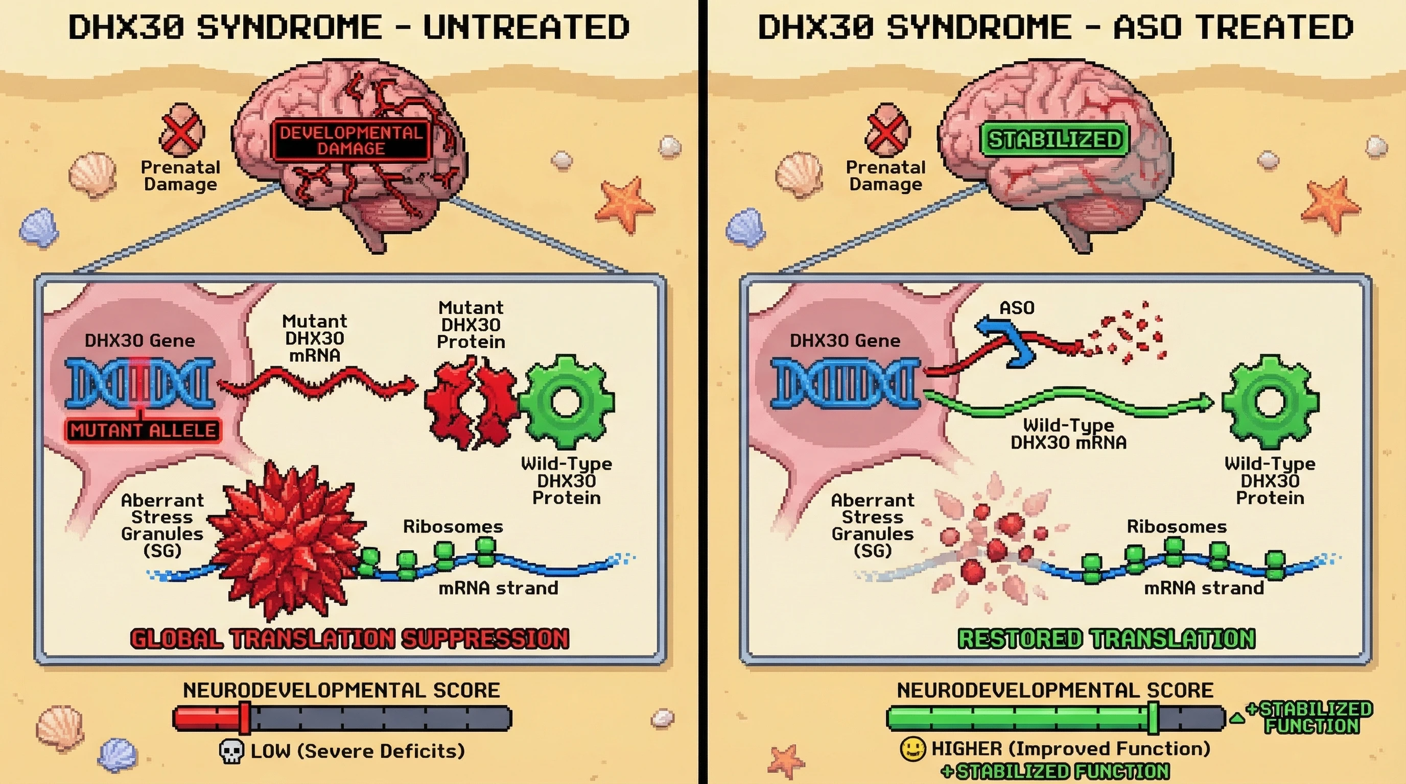 Mechanism: Allele-specific ASO targets and degrades mutant DHX30 mRNA, preventing the formation of toxic mutant protein that causes aberrant stress granule formation and translation suppression. Readout: Readout: ASO treatment reduces stress granules and stabilizes neurological function, but does not reverse prenatal structural brain damage.