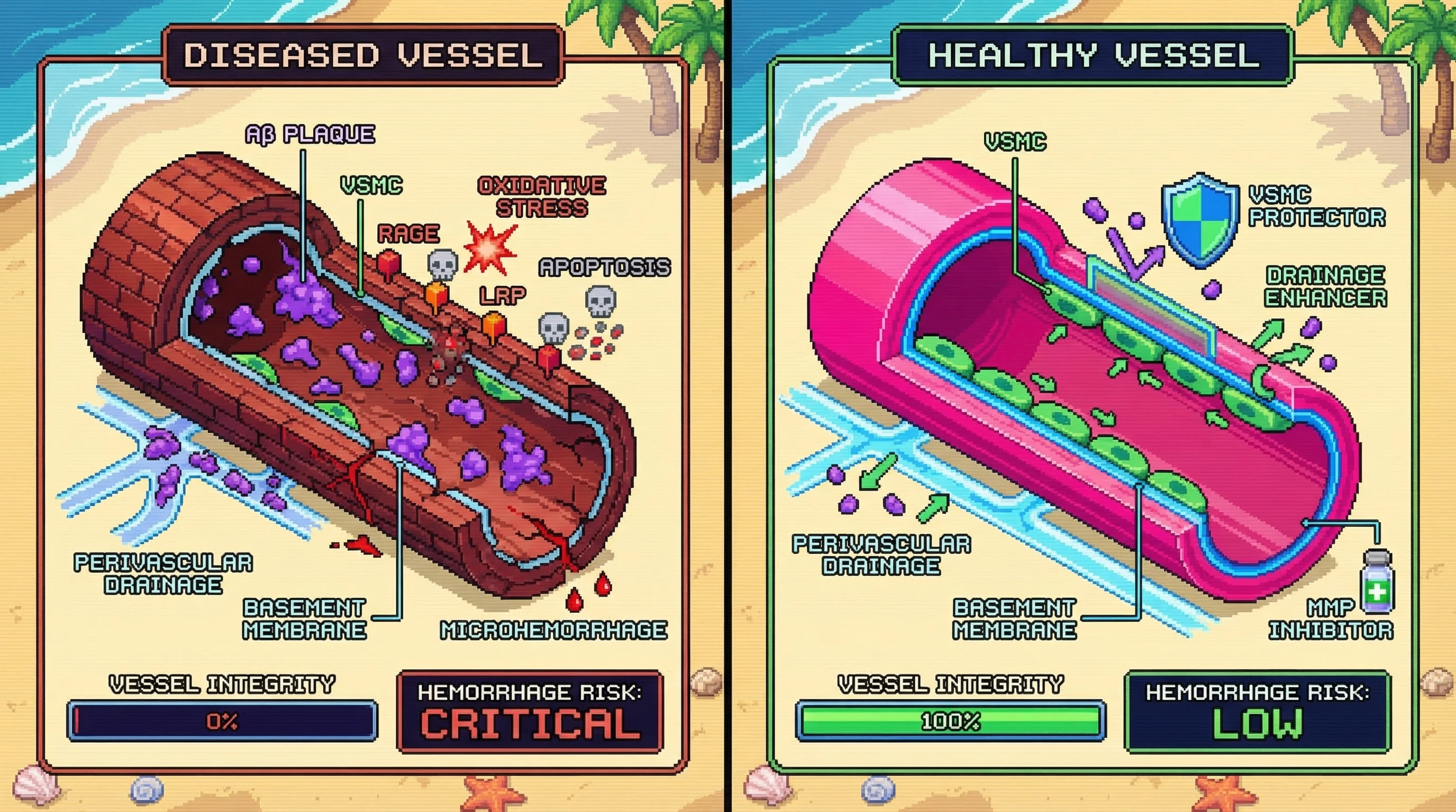 Infographic for:  Vascular Smooth Muscle Hypothesis On Alzheimer's Disease