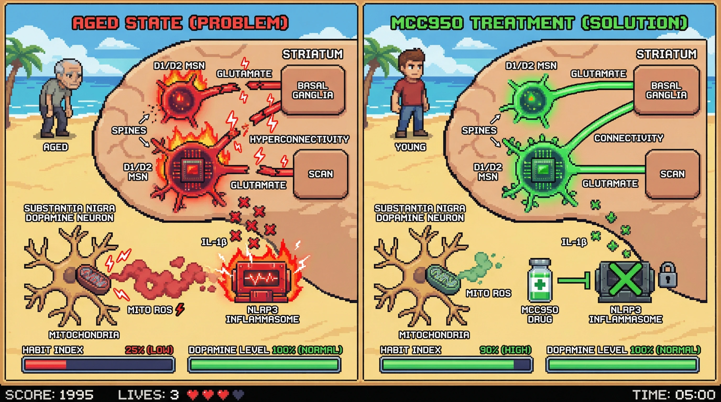 Infographic for: Mitochondrial ROS/NLRP3 signaling in aging dopaminergic neurons drives inflammatory re‑programming of D1/D2 co‑expressing striatal neurons, leading to SCAN hyperconnectivity and habit loss before dopamine depletion