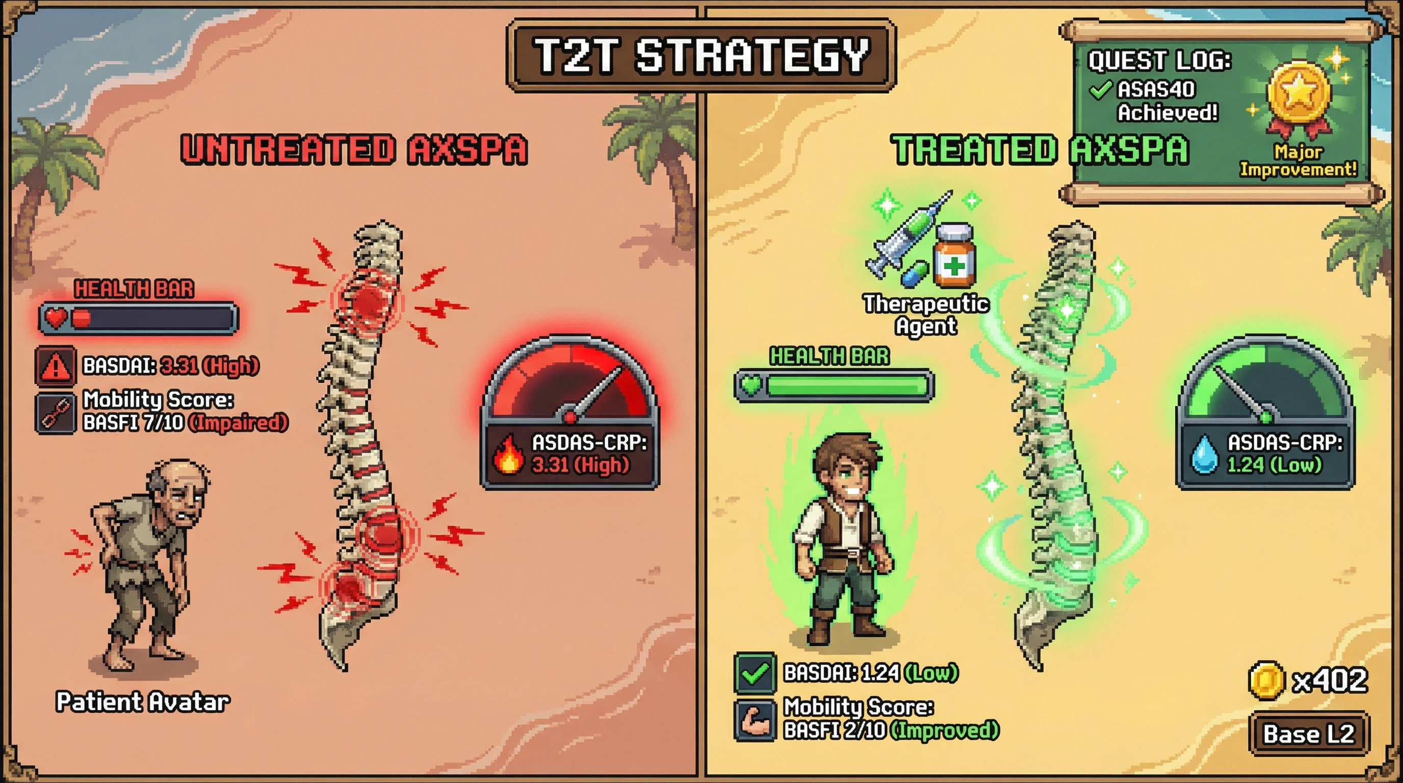 Infographic for: AxSpA-MODEL: Axial Spondyloarthritis Disease Model with BASDAI, ASDAS, BASFI, BASMI, and ASAS Response