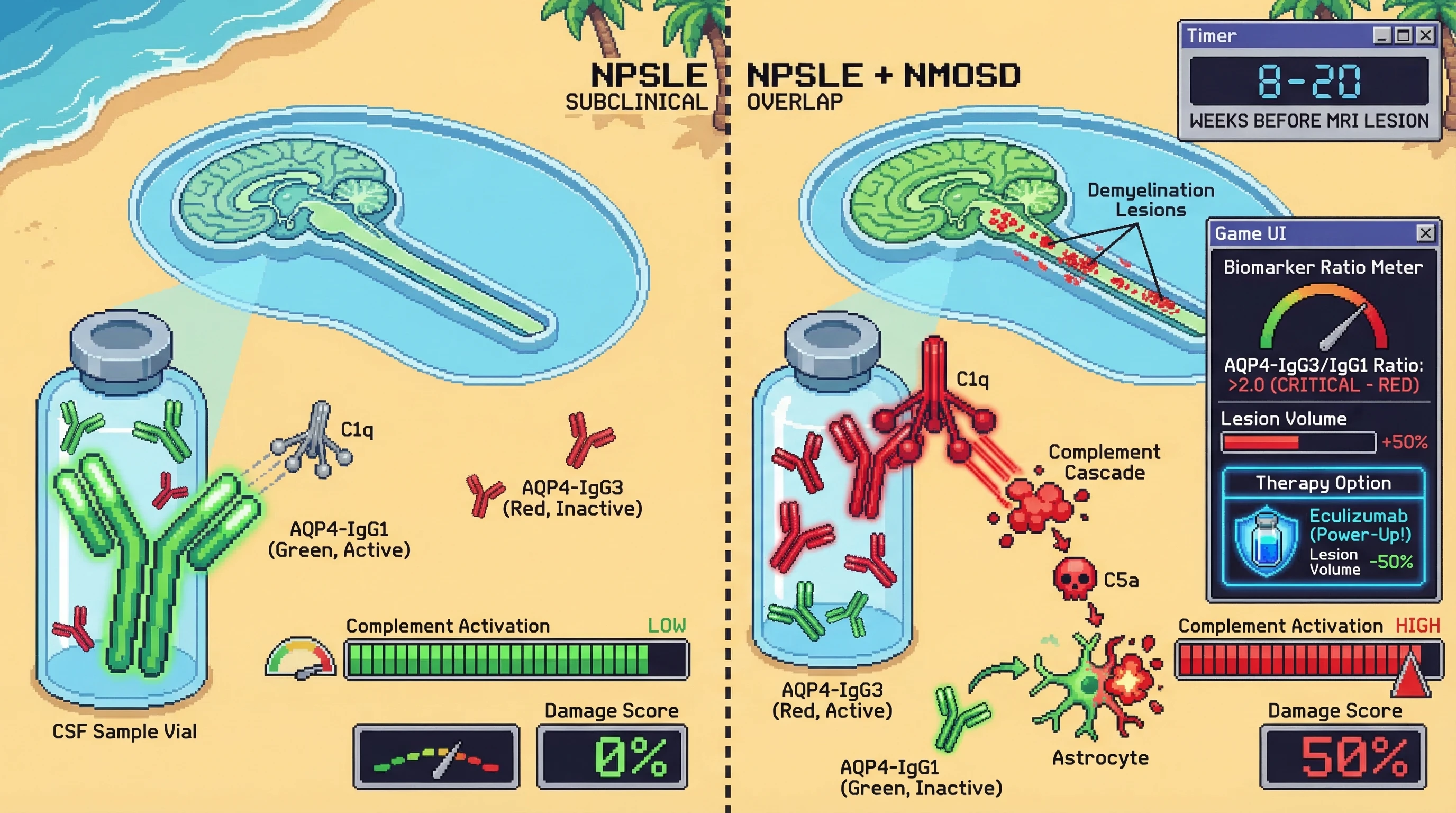 Mechanism: A shift from AQP4-IgG1 to AQP4-IgG3 dominance in CSF drives complement activation and astrocytopathy in NPSLE patients. Readout: Readout: An AQP4-IgG3/IgG1 ratio 2.0 predicts NMOSD-pattern MRI lesions 8-20 weeks prior, and eculizumab can reduce lesion volume by 50%.