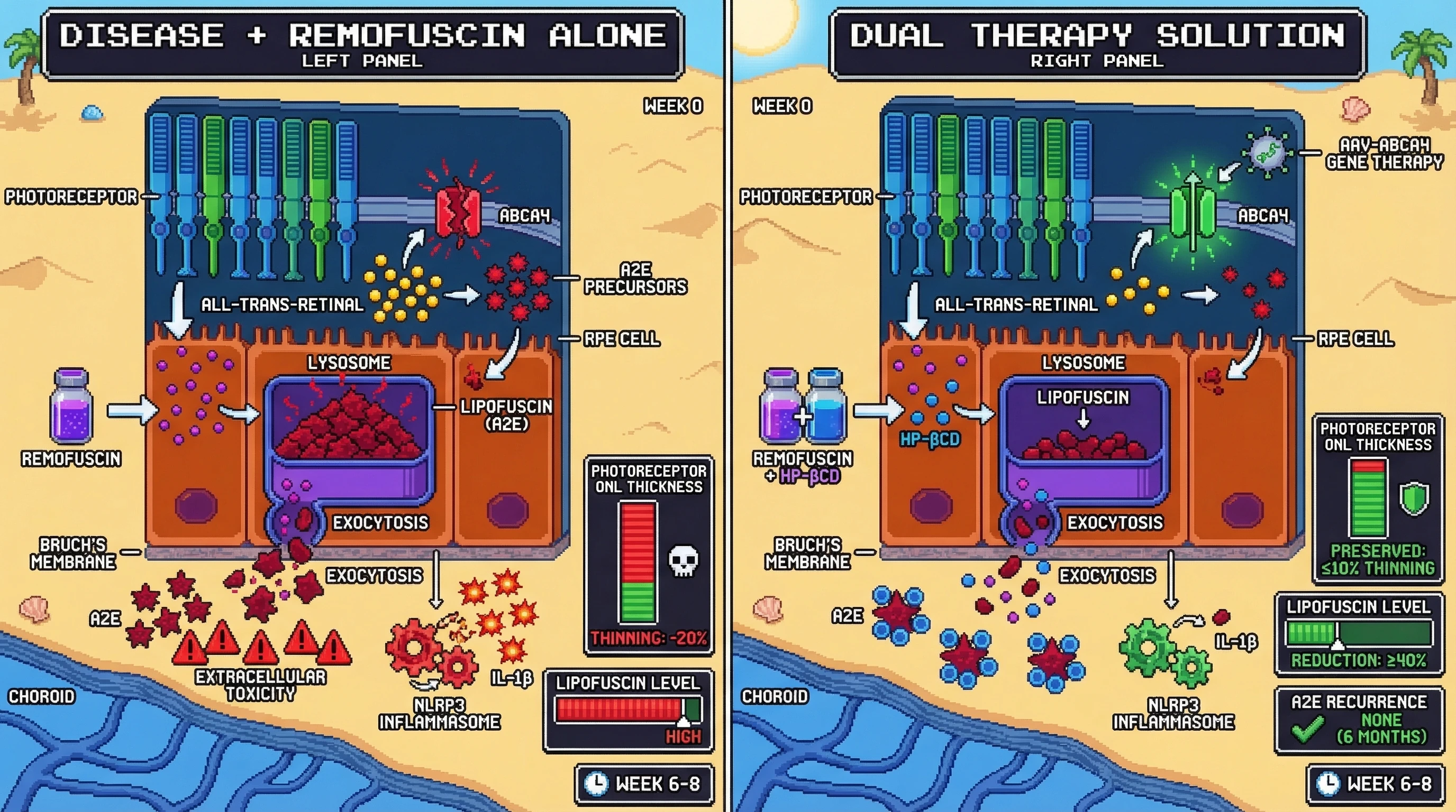 Infographic for: Sequential sub-retinal AAV-ABCA4 gene augmentation followed by intravitreal co-delivery of remofuscin and hydroxyprop...
