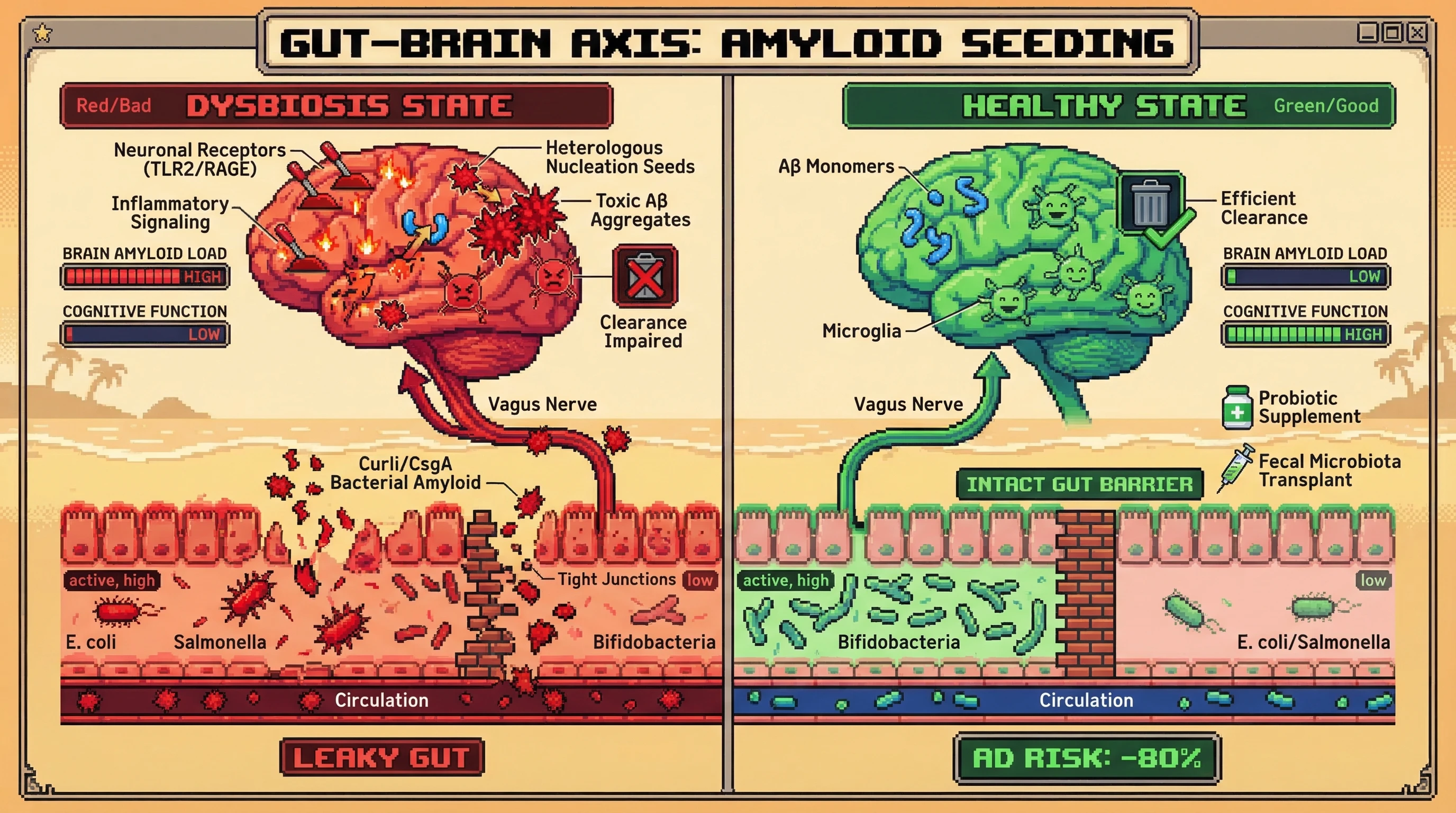 Mechanism: Gut dysbiosis leads to bacterial amyloid release, which crosses the gut barrier and seeds toxic Aβ aggregation in the brain, driving Alzheimer's pathology. Readout: Readout: In healthy states, brain amyloid load is low, and cognitive function is high, with AD risk reduced by 80%.