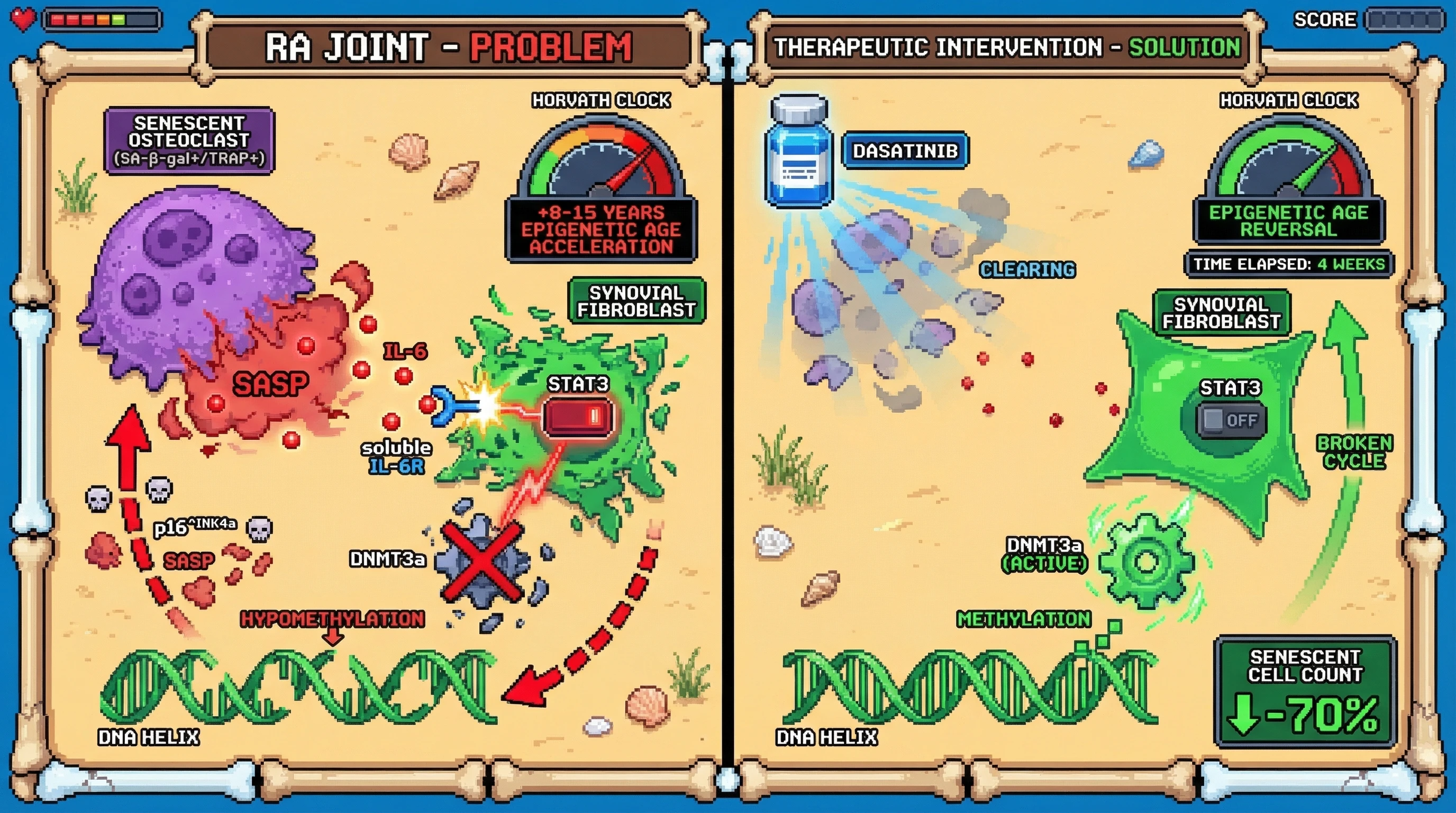 Infographic for: Senescent Osteoclast-Derived IL-6 Trans-Signaling Accelerates Epigenetic Age in Rheumatoid Arthritis via DNMT3a Downregulation
