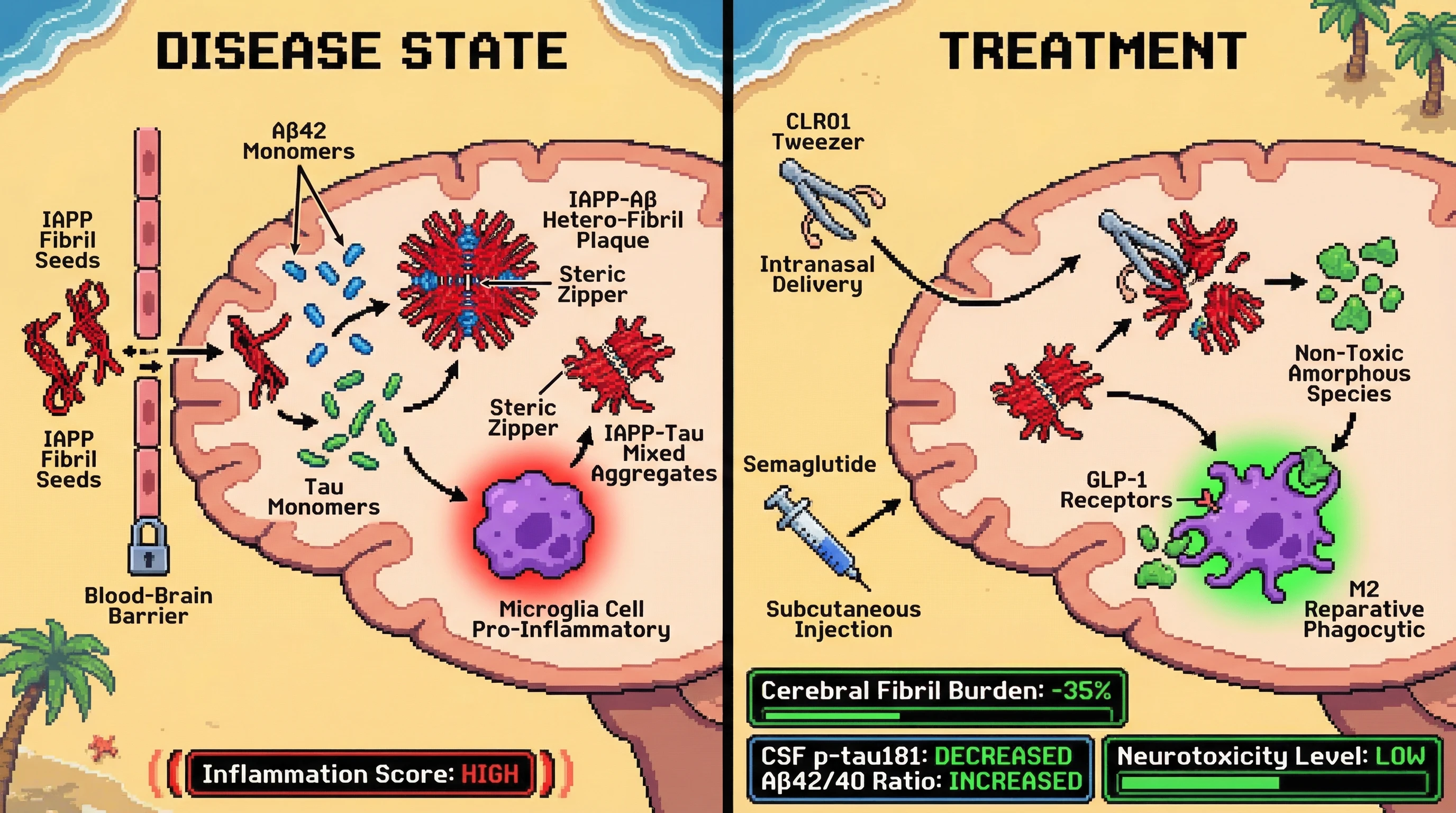 Mechanism: CLR01 molecular tweezers disaggregate existing IAPP-Aβ hetero-fibrils and IAPP-tau mixed aggregates, while semaglutide shifts microglia to a reparative phagocytic state, clearing non-toxic fragments. Readout: Readout: Cerebral IAPP-seeded Aβ42 hetero-fibril burden and IAPP-tau mixed aggregate load are reduced by 30-40%, with decreased CSF p-tau181 and increased Aβ42/40 ratio.