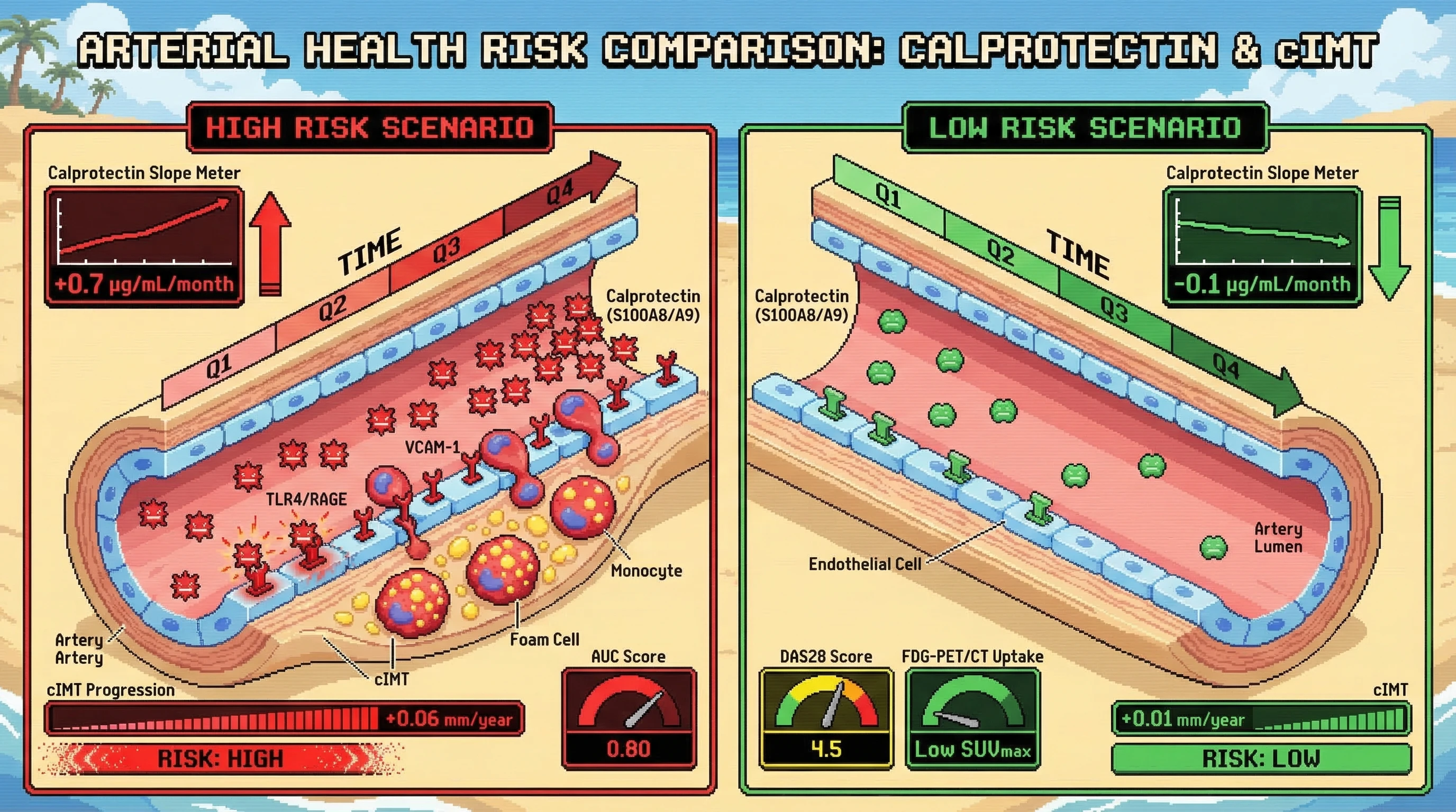 Infographic for: Serum Calprotectin (S100A8/A9) Trajectory Slope Over 12 Months Predicts Subclinical Carotid Atherosclerosis Progression in Rheumatoid Arthritis Independent of Traditional Cardiovascular Risk Factors