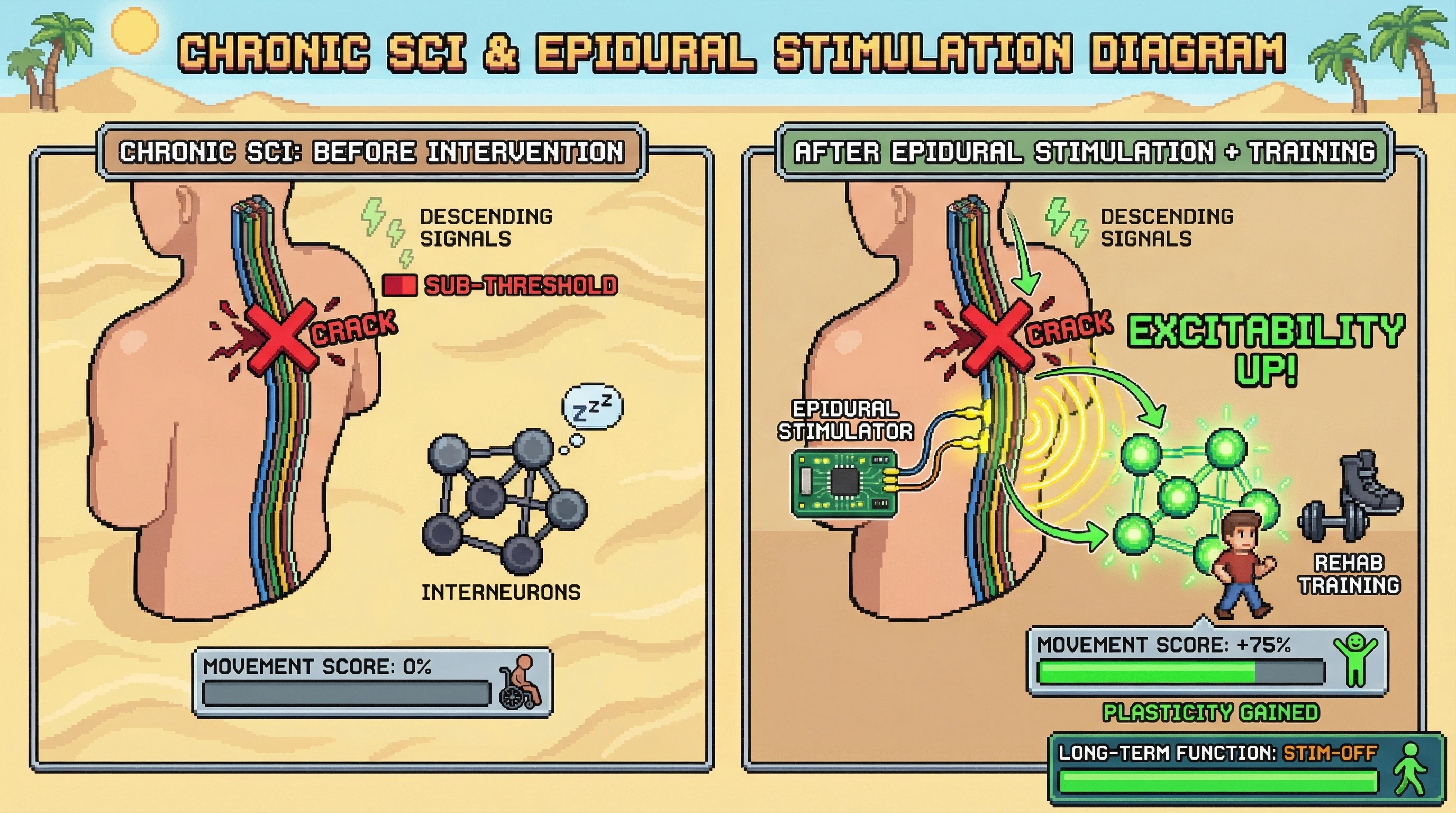 This infographic illustrates how epidural stimulation combined with activity-based training activates dormant interneuronal circuits below a spinal cord injury, enabling previously sub-threshold brain signals to restore voluntary movement and demonstrating network-level plasticity.