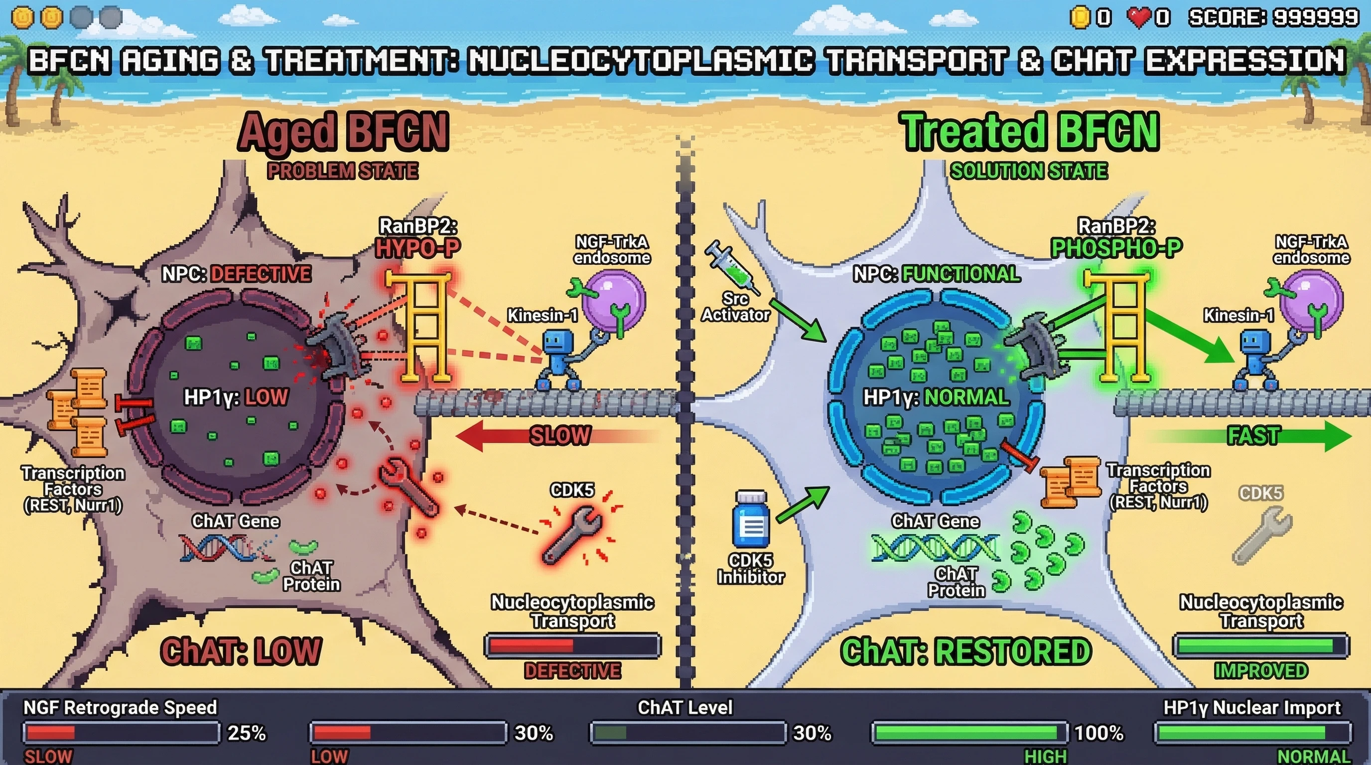 Infographic for: Hypothesis: Nucleocytoplasmic Transport Collapse Drives Cholinergic Decline via RanBP2‑Dependent Kinesin Dysregulation