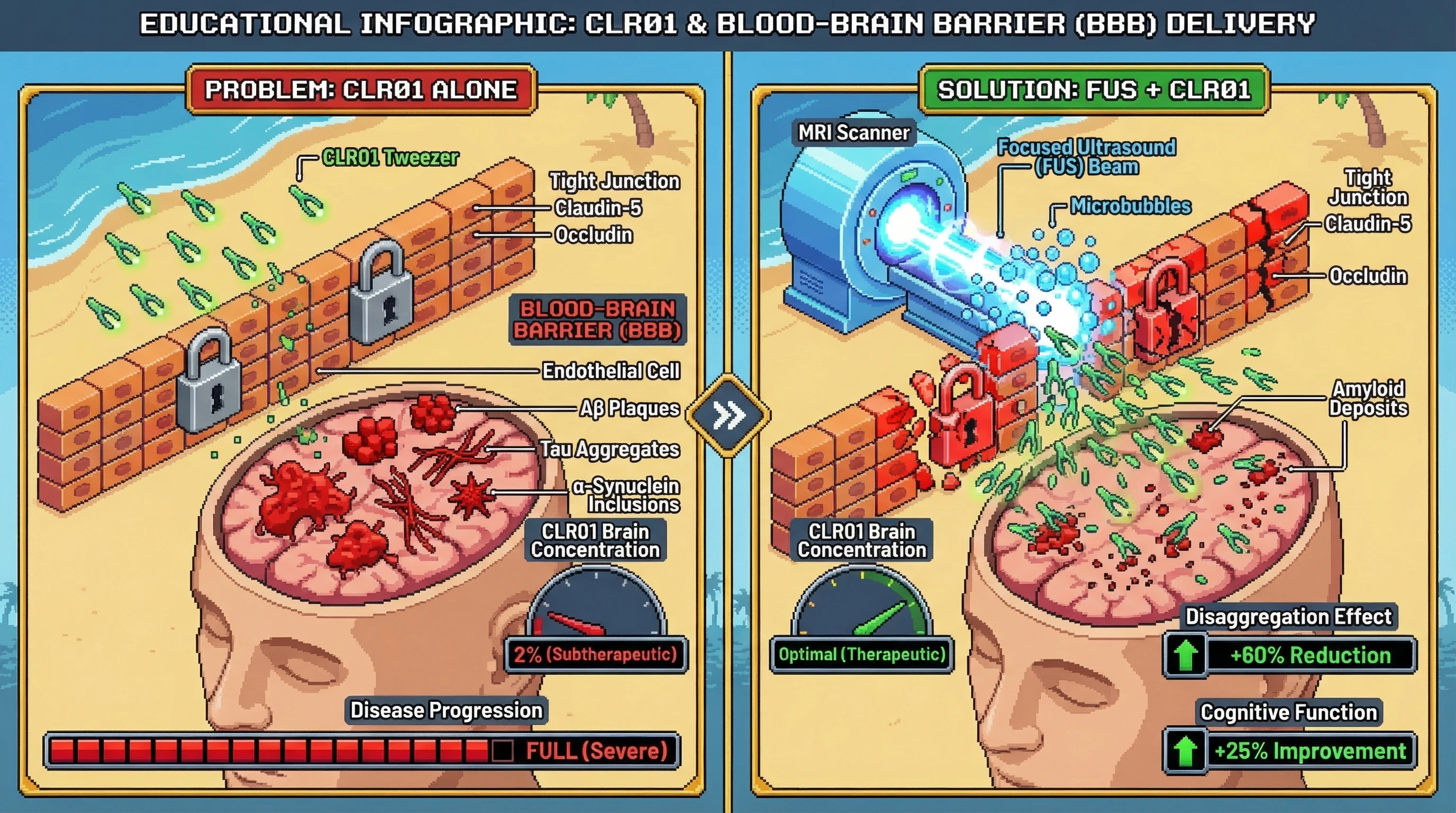 Mechanism: Focused Ultrasound (FUS) temporarily opens the Blood-Brain Barrier, allowing therapeutic concentrations of the CLR01 'molecular tweezer' to reach and disaggregate amyloid deposits. Readout: Readout: Amyloid burden is reduced by over 60%, accompanied by measurable improvements in cognitive function.