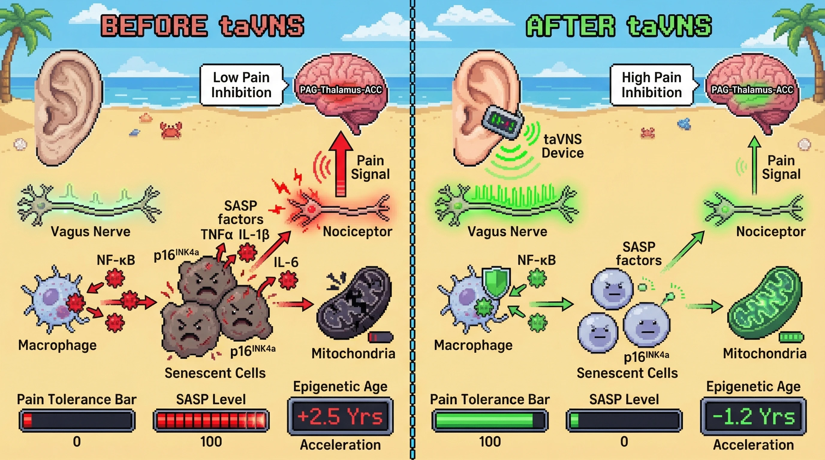 Mechanism: Transcutaneous auricular vagus nerve stimulation (taVNS) enhances vagal tone, inhibiting NF-κB activation and reducing senescent cell burden and SASP factor secretion. Readout: Readout: This leads to increased pain tolerance and reduced epigenetic age acceleration by decreasing nociceptor excitability and reinforcing central pain inhibition.