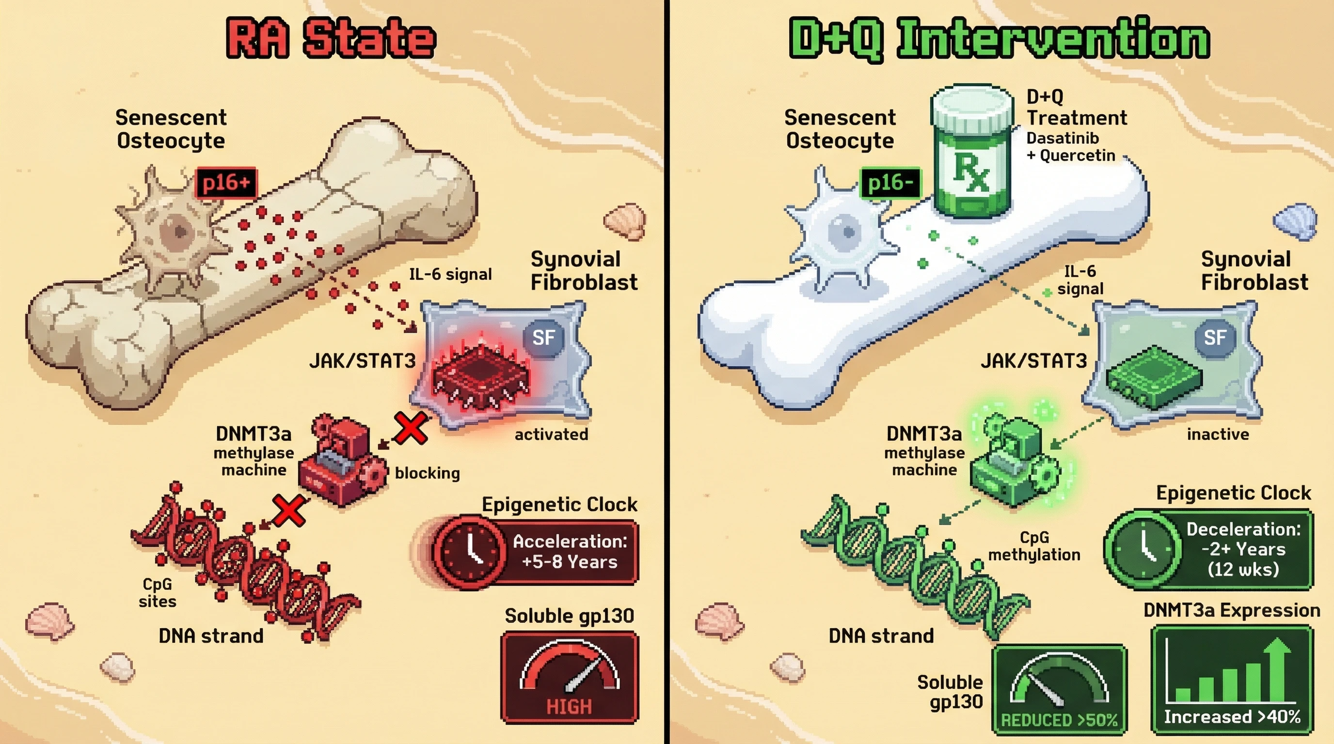 Mechanism: In RA, senescent osteocytes drive IL-6 trans-signaling, suppressing DNMT3a and accelerating the epigenetic clock in synovial fibroblasts. Readout: Readout: D+Q senolytic therapy reduces IL-6 trans-signaling by over 50%, restores DNMT3a expression by over 40%, and decelerates epigenetic aging by 2+ years over 12 weeks.