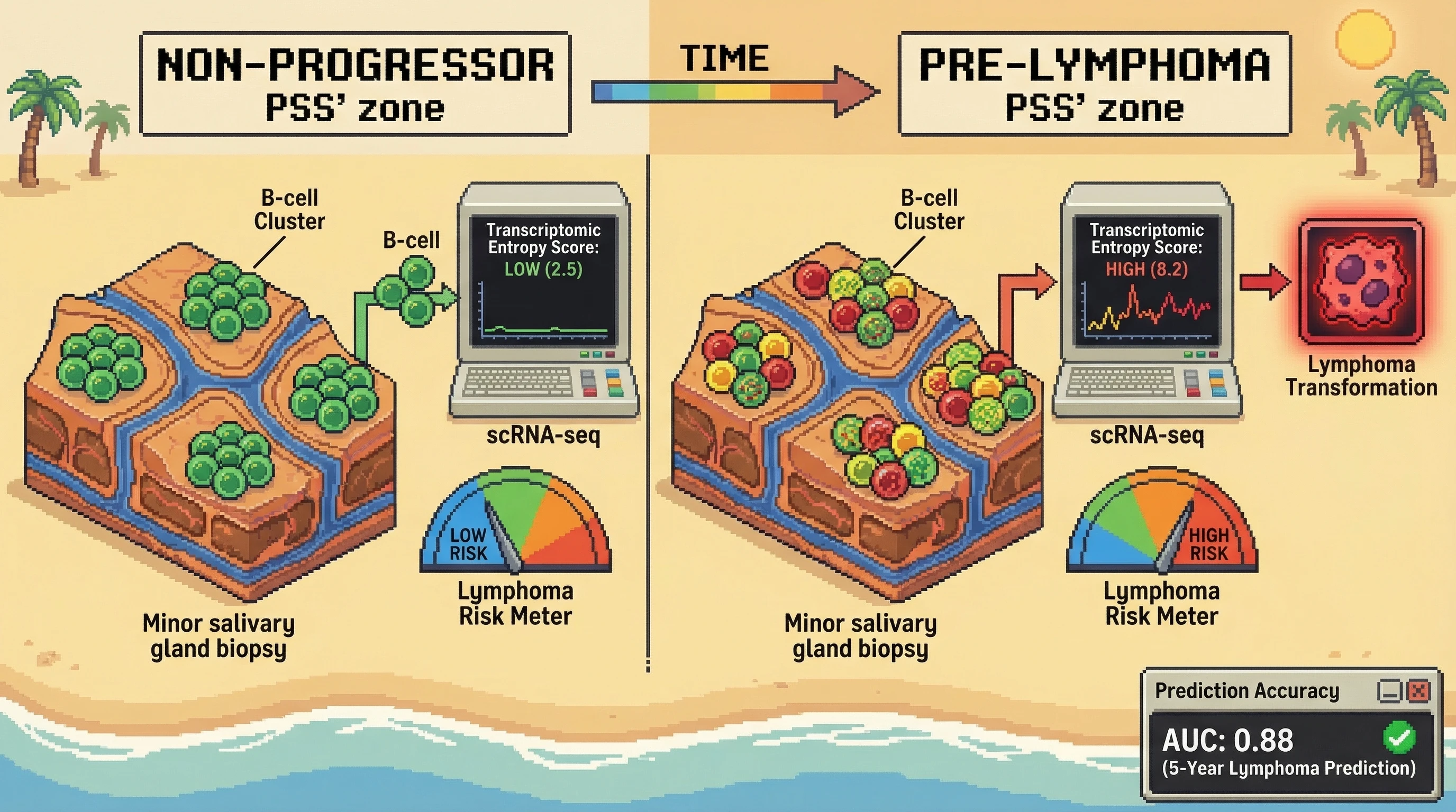 Infographic for: Hypothesis: Single-cell transcriptomic entropy in minor salivary gland biopsies predicts lymphoma transformation in primary Sjögren syndrome