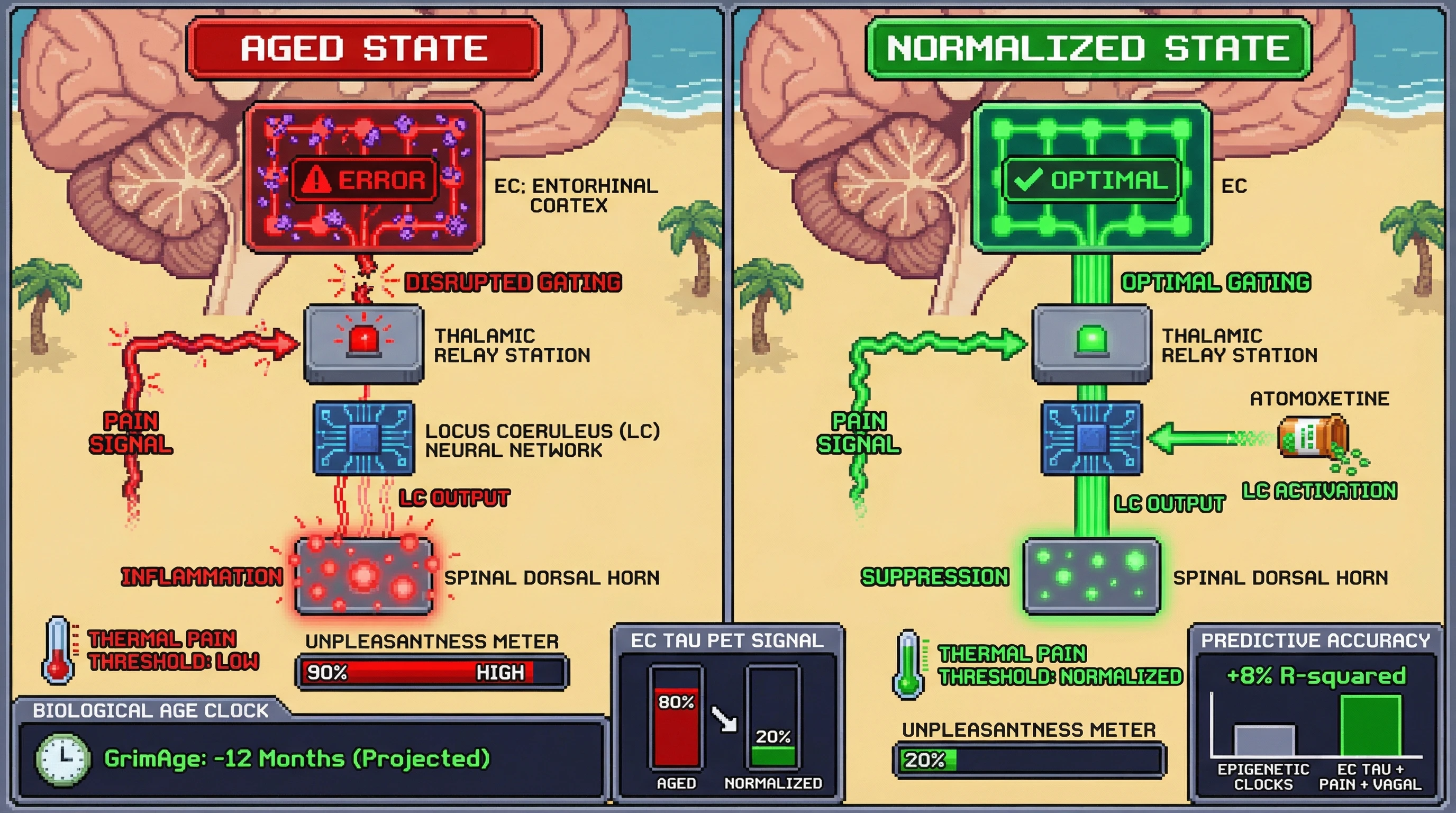 Infographic for: Entorhinal Tau Disrupts Descending Pain Modulation, Making Thermal Sensitivity a Proxy for Neurobiological Aging