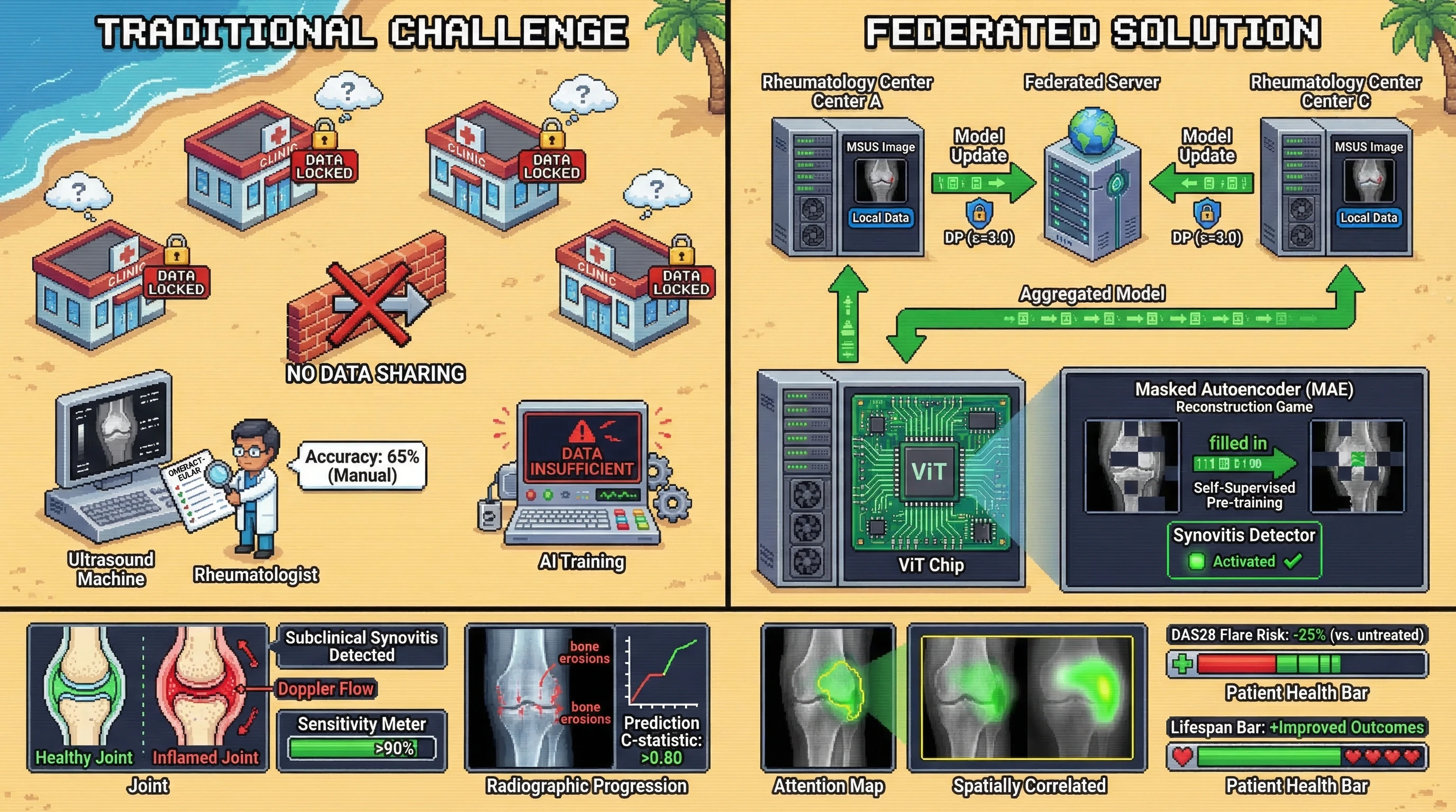 Infographic for: Federated Self-Supervised Vision Transformers on Multi-Center Musculoskeletal Ultrasound Detect Subclinical Synovitis in Rheumatoid Arthritis With >90% Sensitivity While Preserving Institutional Data Sovereignty
