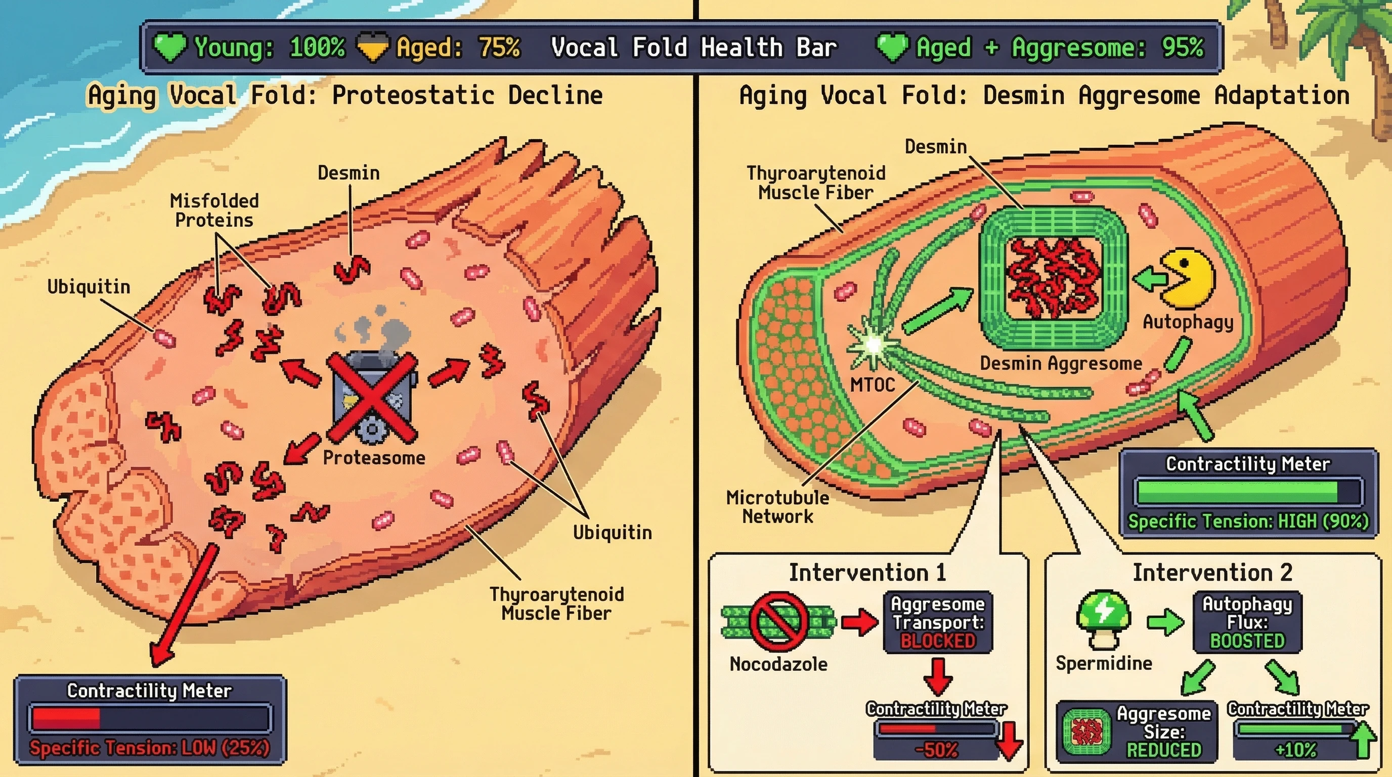 Mechanism: In aging vocal folds, desmin forms organized aggresomes that sequester misfolded sarcomeric proteins, thereby preserving muscle contractility. Readout: Readout: This adaptation maintains high specific tension and overall vocal fold health compared to diffuse protein aggregation.