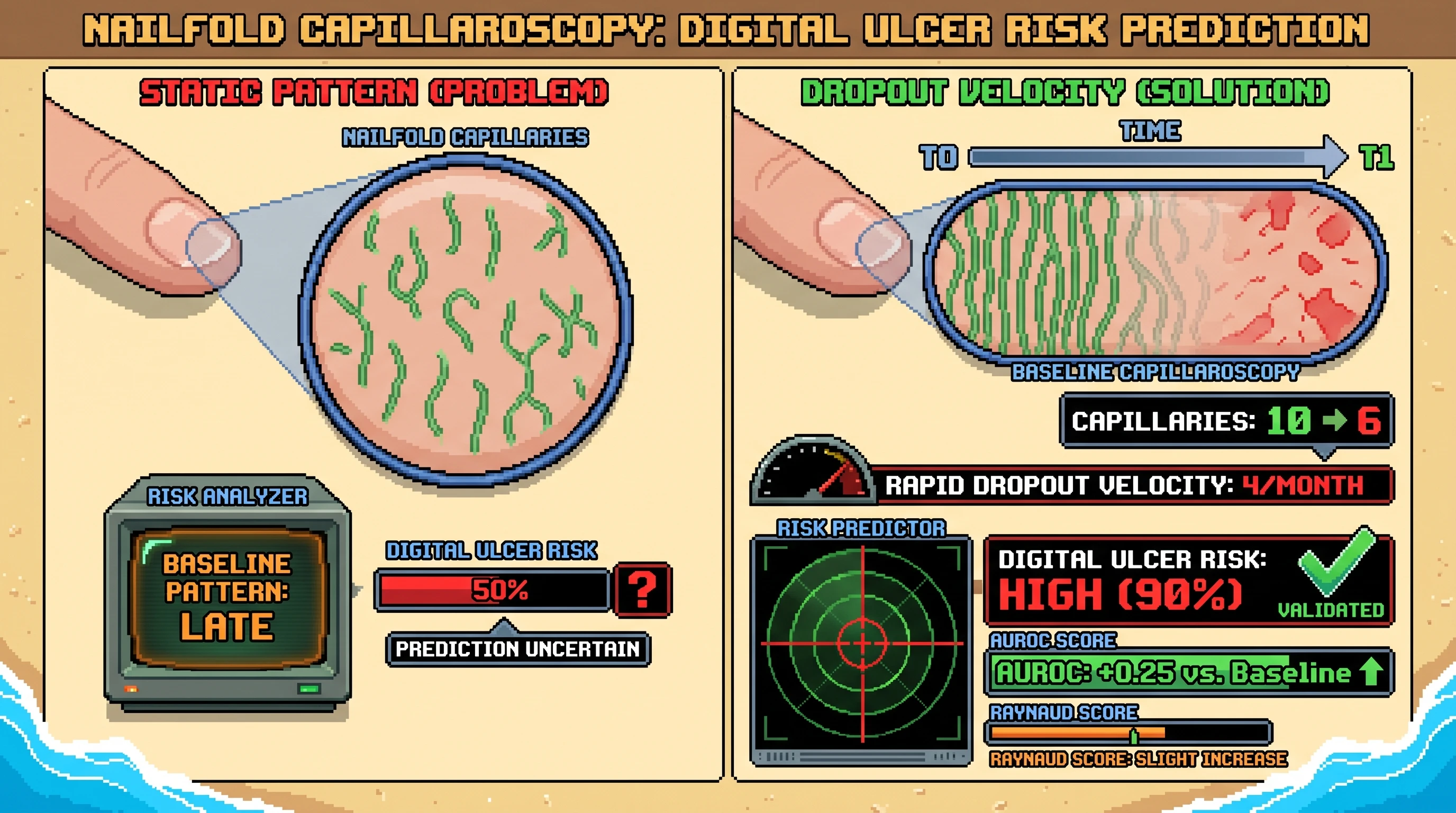 Infographic for: Hypothesis: Capillary dropout velocity predicts near-term digital ulcer risk in systemic sclerosis better than baseline nailfold pattern alone