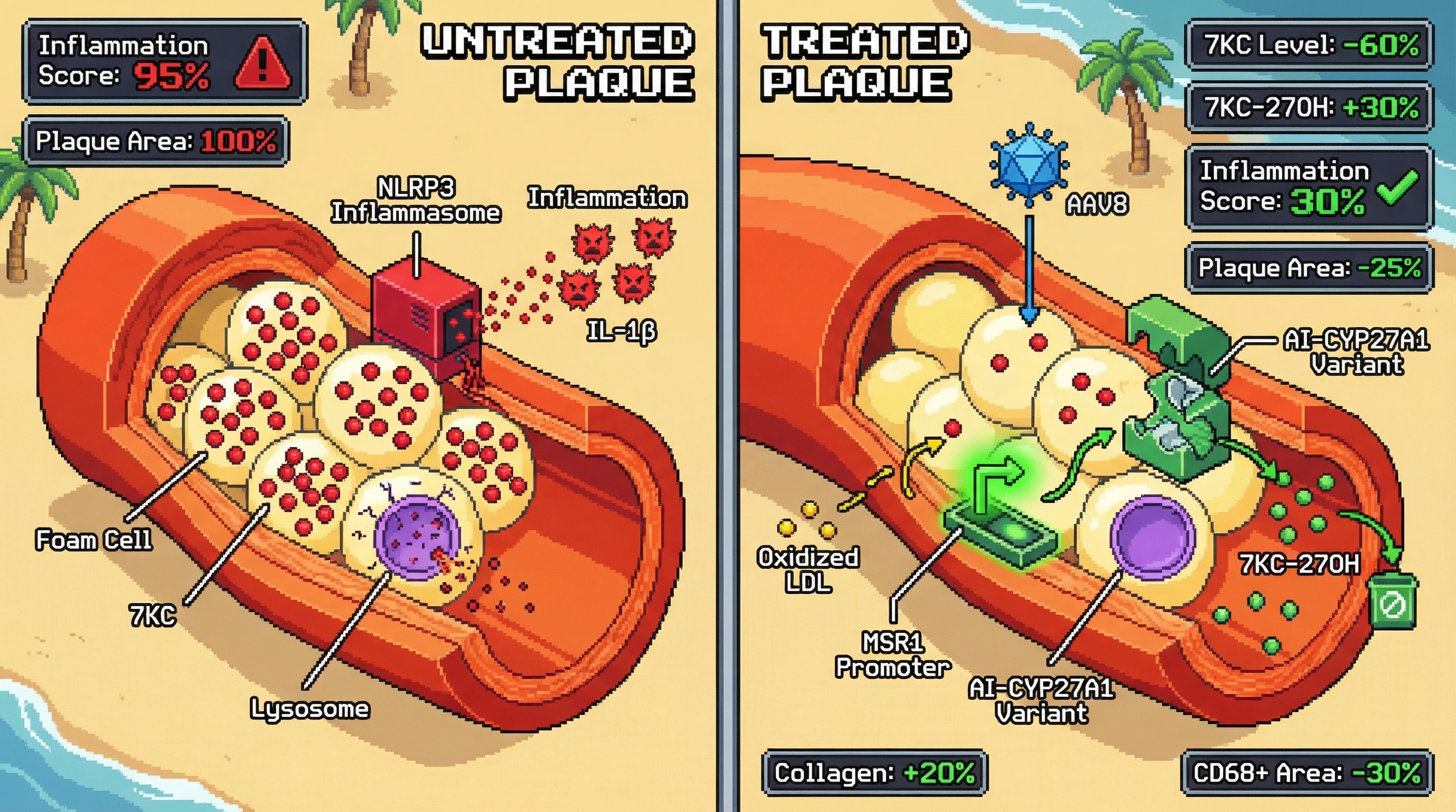 Infographic for: An AI-redesigned CYP27A1 variant, delivered by AAV8 under a foam-cell-responsive MSR1 promoter, creates a self-amplif...
