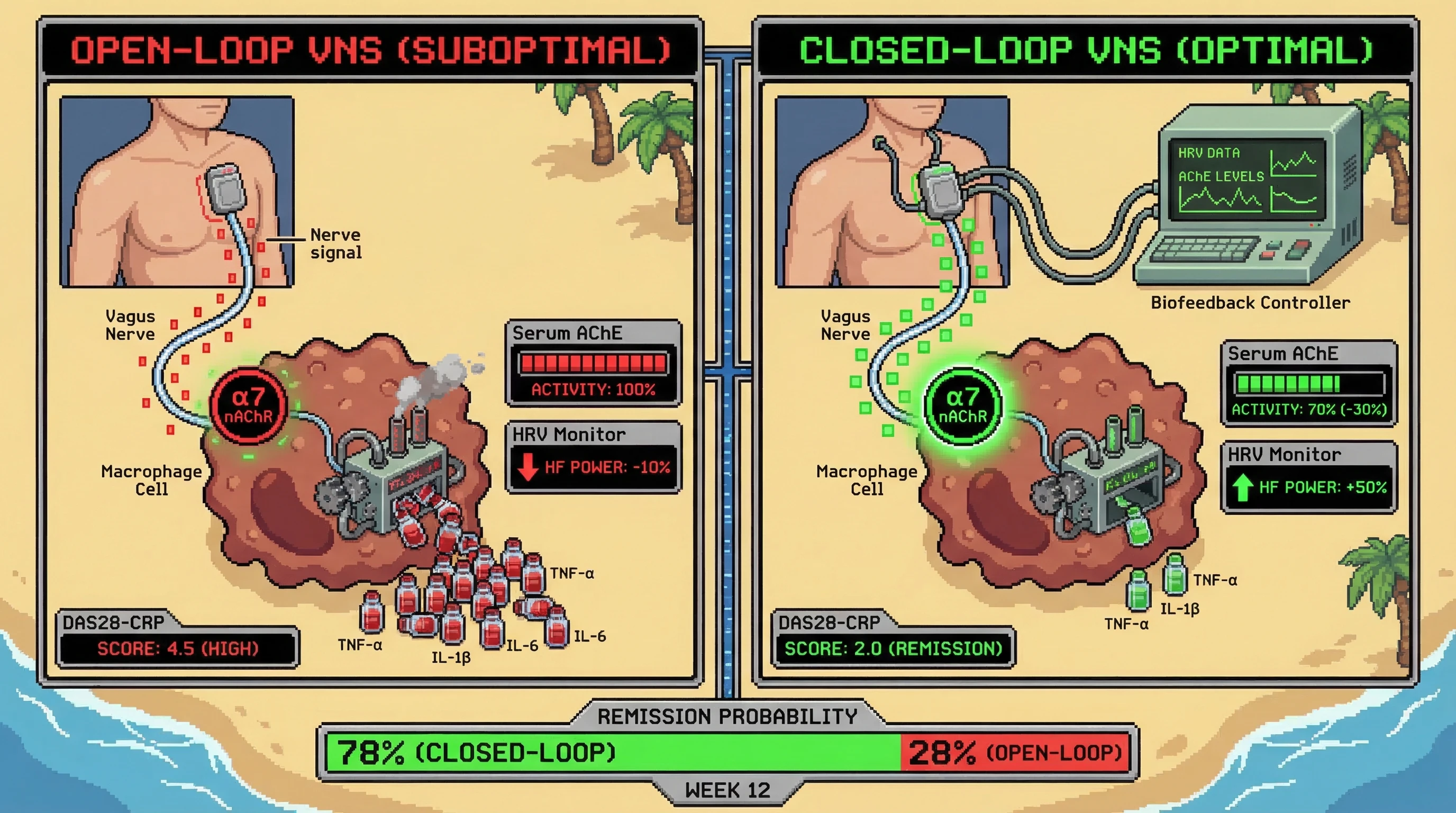 Infographic for: HRV-Guided Closed-Loop Vagus Nerve Stimulation Combined With Serum Acetylcholinesterase Activity Monitoring Optimizes Cholinergic Anti-Inflammatory Pathway Activation and Predicts DAS28 Remission in Biologic-Refractory Rheumatoid Arthritis Within 12 Weeks