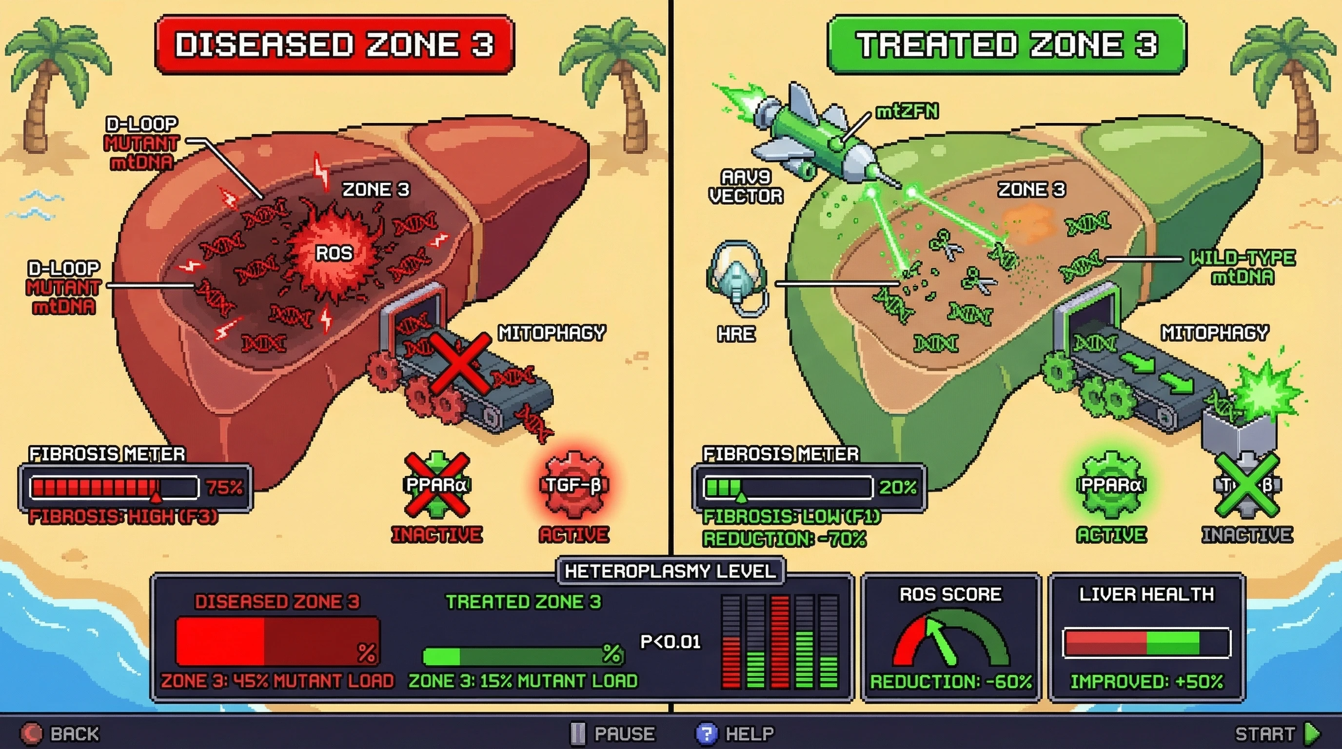Infographic for: Zone-Specific mtDNA Heteroplasmy as the Driver of NAFLD Progression: A Testable Hypothesis for Mitochondrial Genome Editing