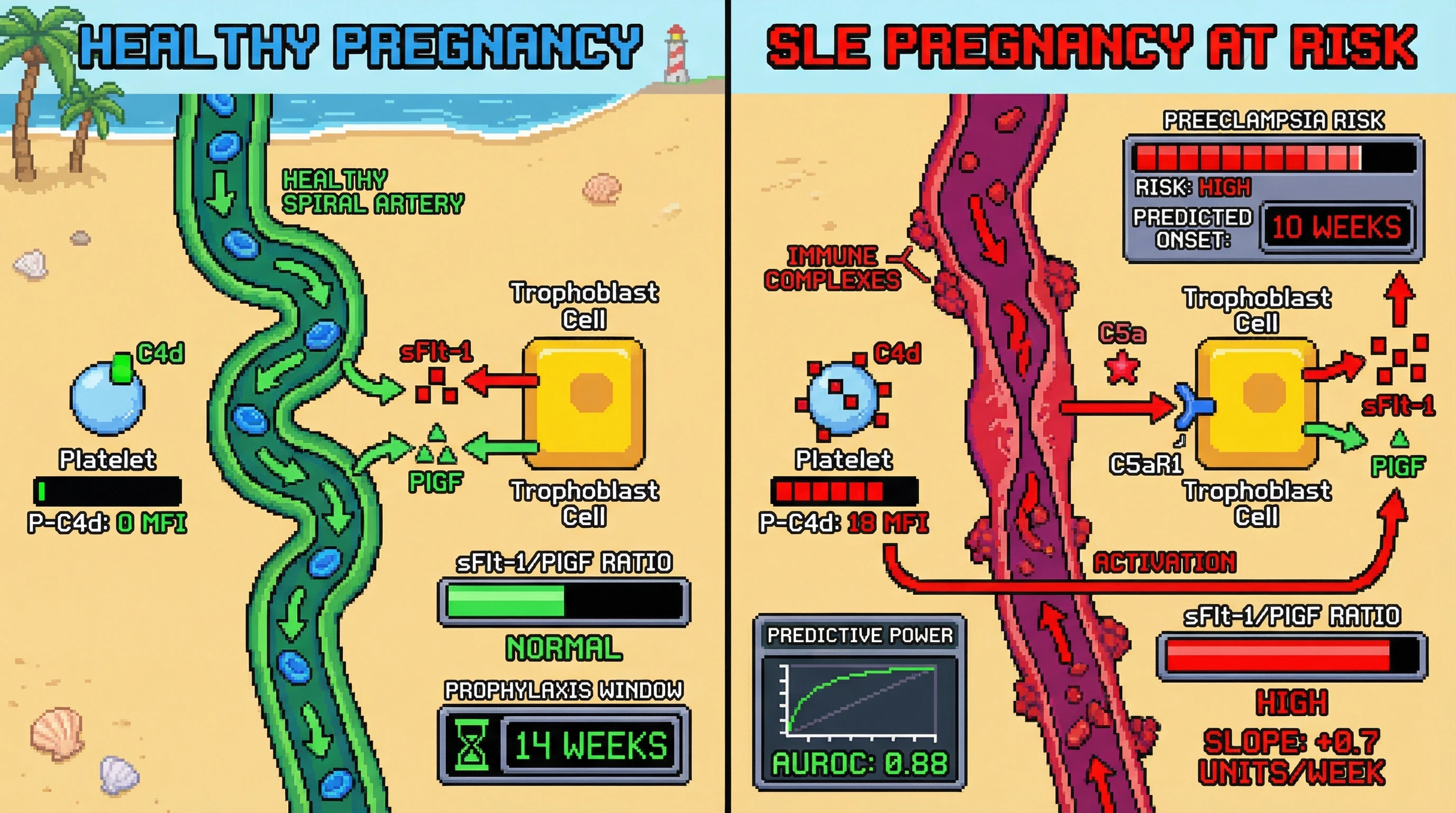 Mechanism: In SLE pregnancies, immune complexes activate complement at placental spiral arteries, leading to C4d binding platelets and increased trophoblast sFlt-1 via C5a. Readout: Readout: Elevated P-C4d and a high sFlt-1/PlGF slope jointly predict preeclampsia onset up to 14 weeks in advance with AUROC 0.88.