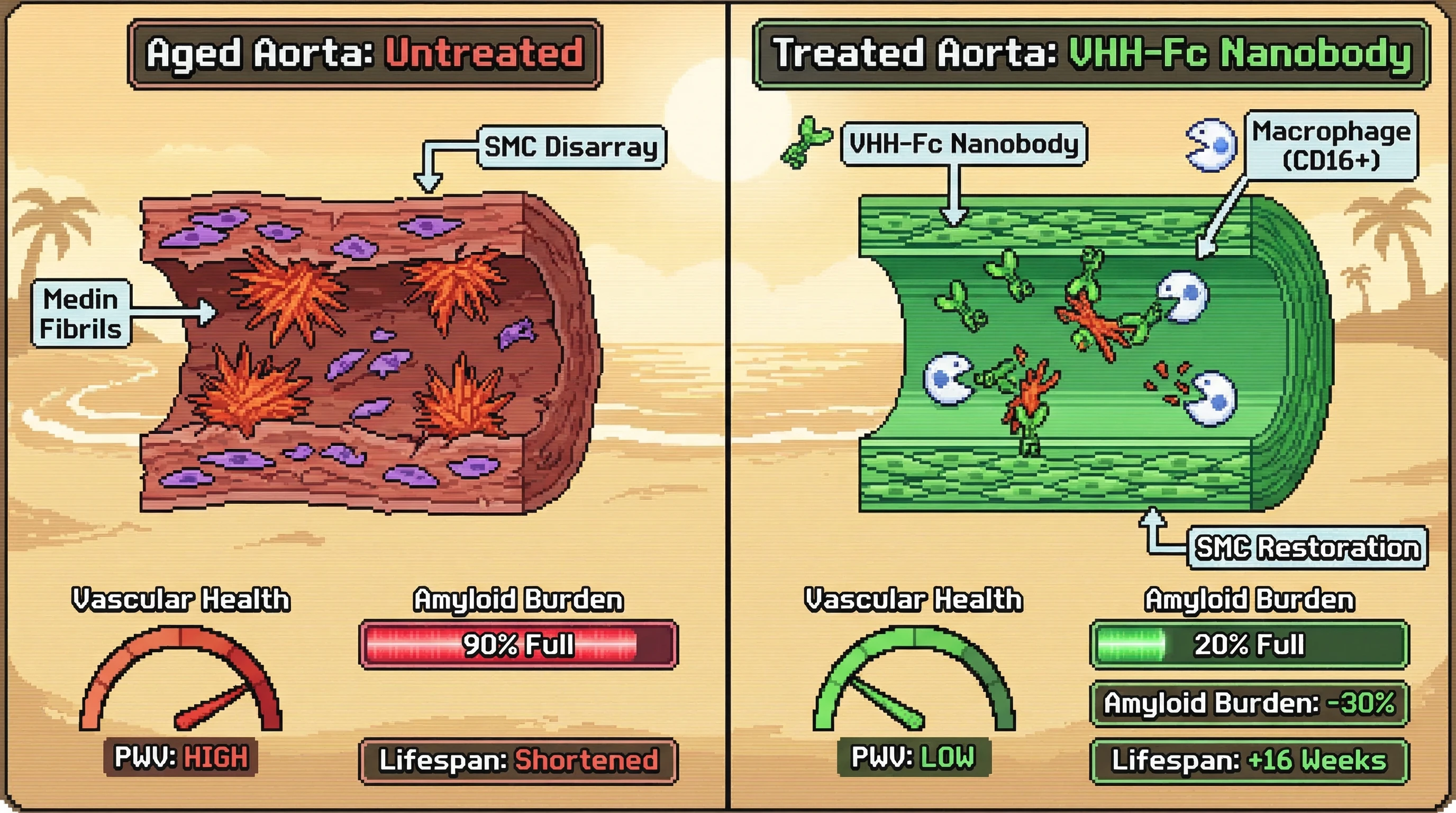 Mechanism: A fibril-selective VHH-Fc nanobody targets and reduces medin amyloid in the aortic media by recruiting macrophages. Readout: Readout: Medin amyloid burden decreases by 30%, aortic pulse wave velocity (PWV) is reduced, and smooth muscle cell (SMC) disarray is reversed over 16 weeks.