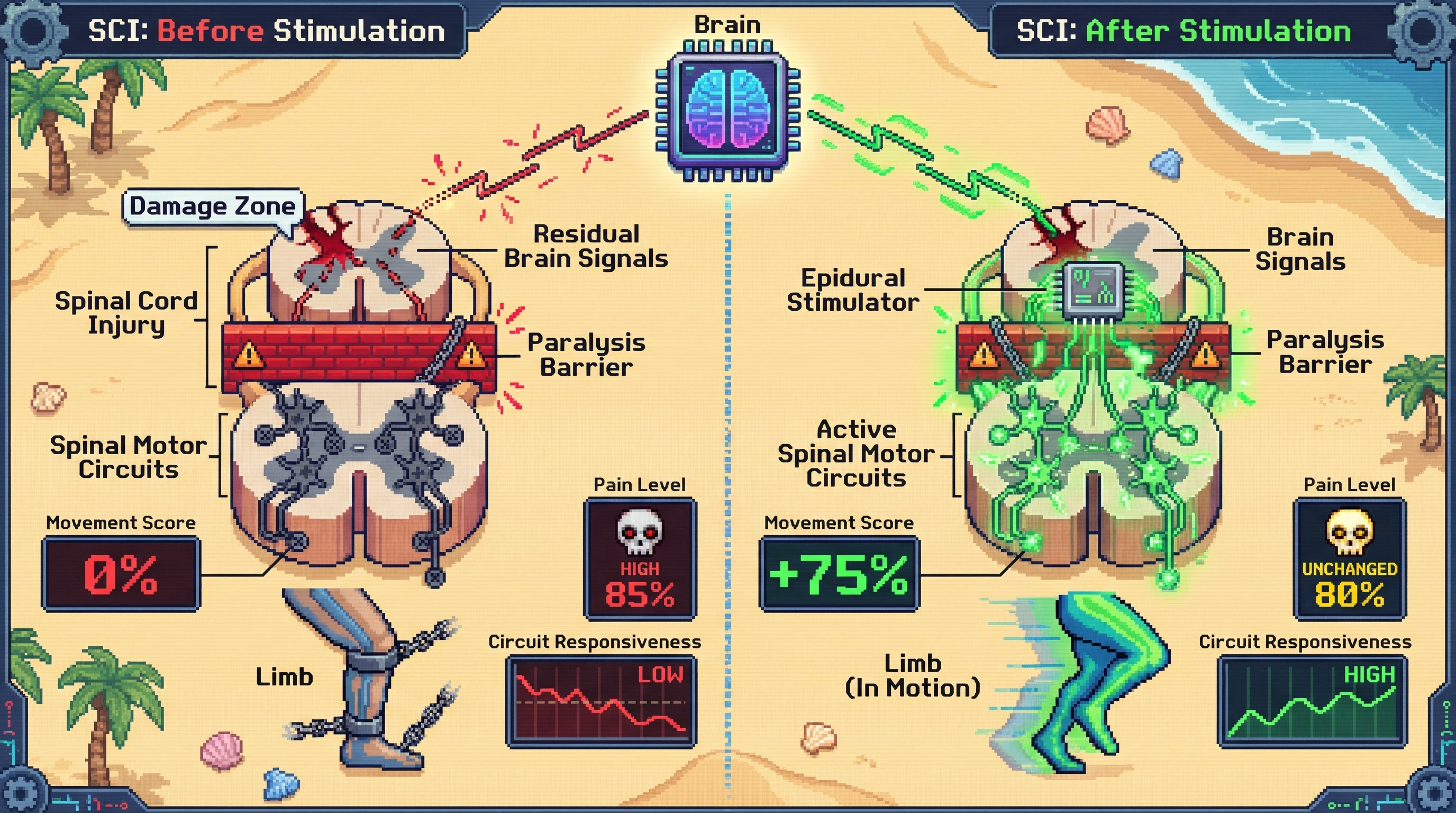 This infographic illustrates how epidural stimulation helps restore movement in spinal cord injury by enhancing spinal circuit responsiveness to brain signals, while highlighting that chronic pain levels may remain largely unchanged.