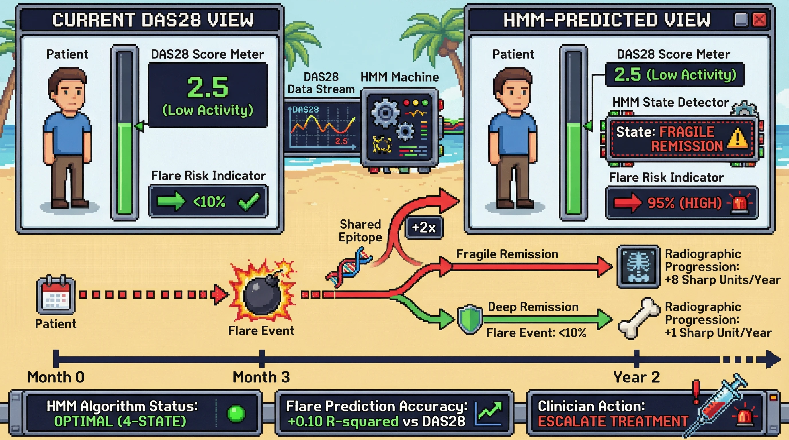 Infographic for: Hypothesis: Hidden Markov Models reveal 4 latent disease states in Rheumatoid Arthritis that predict radiographic progression better than DAS28 alone